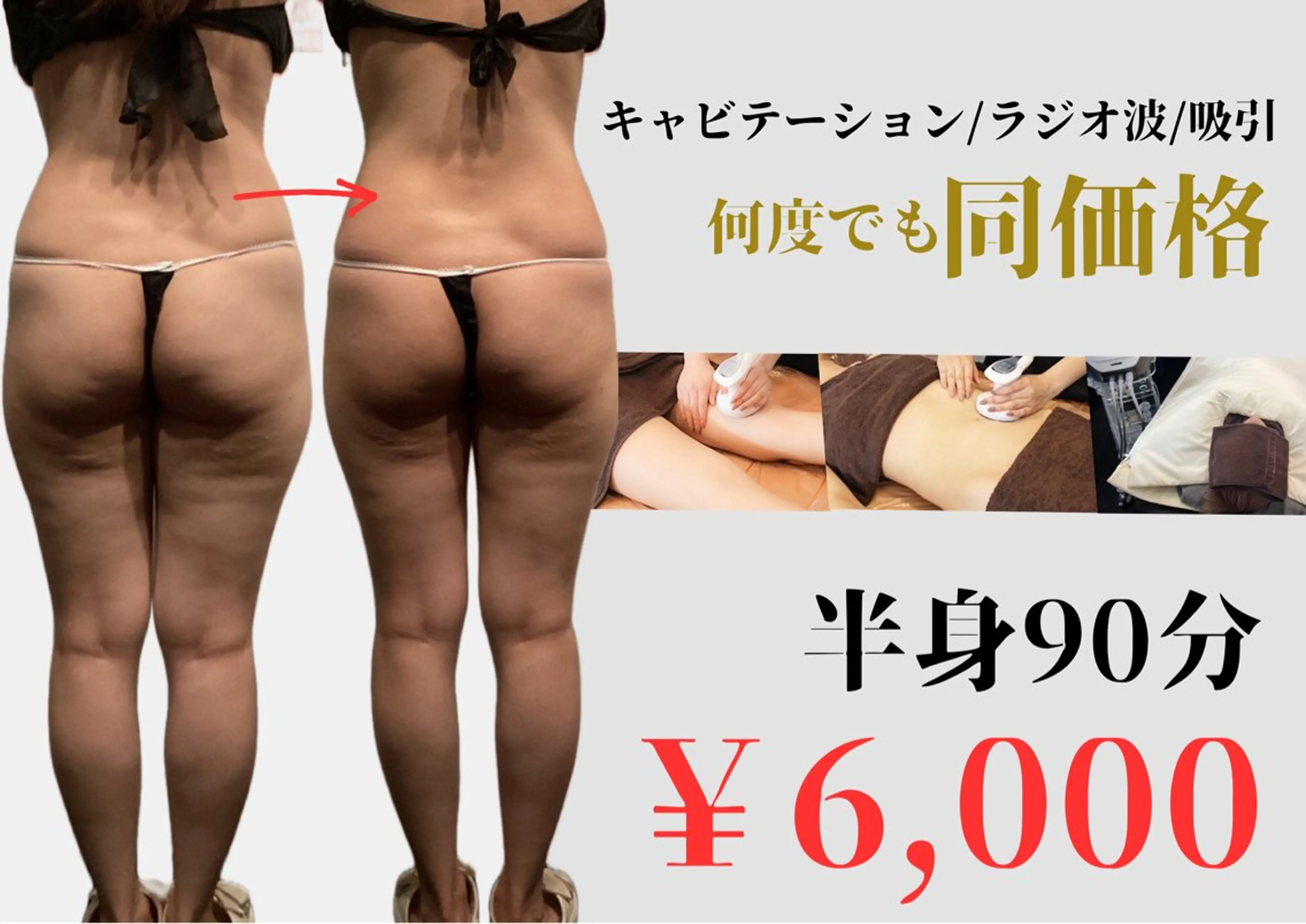 【ずっと同価格】下半身90分♪（発汗最大20分プレゼント）キャビテーション×ラジオ波×吸引🔥¥6000 ※生理中NGの写真