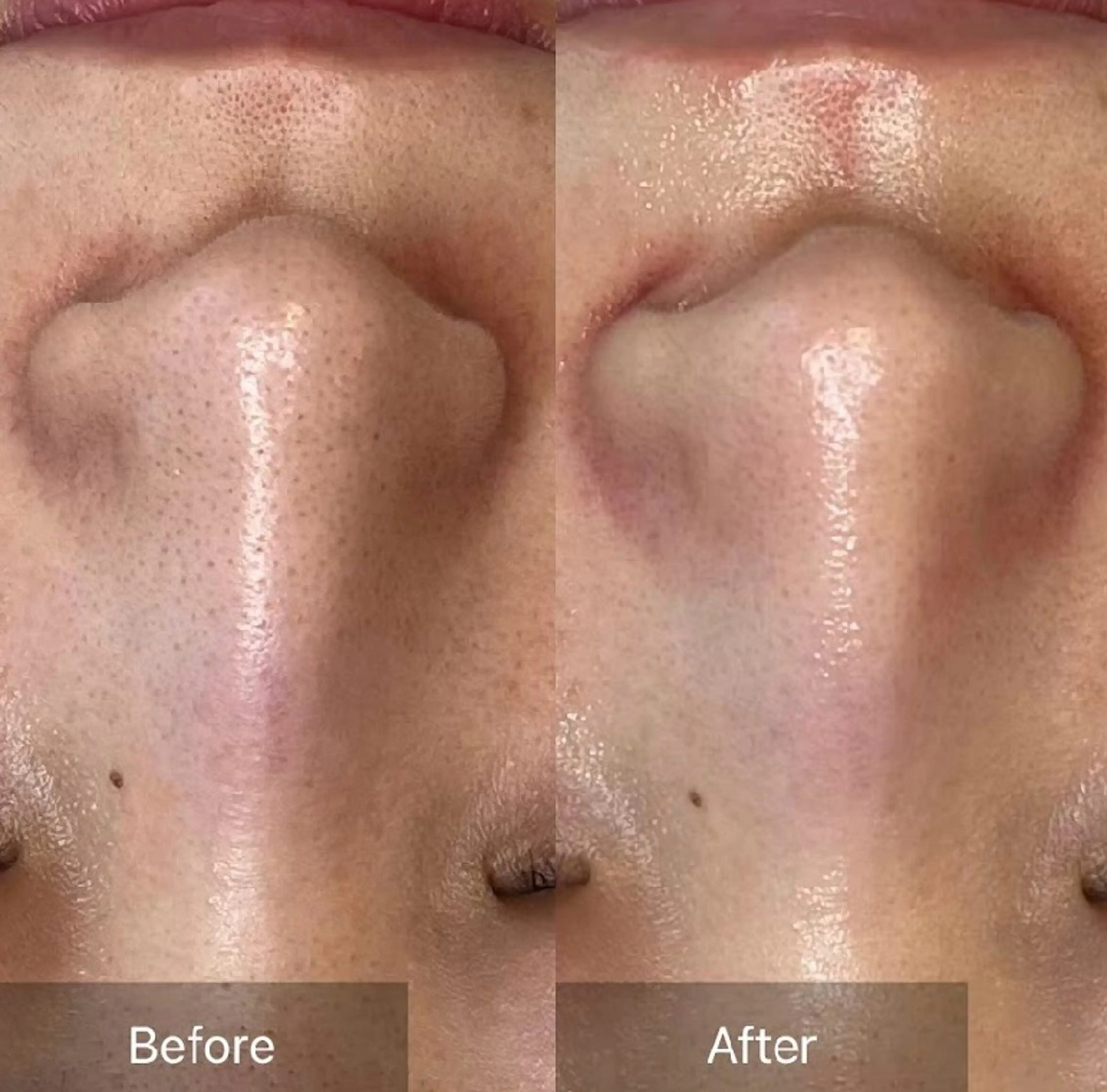 エステ 美u•p 鶴ヶ峰店のマツエク・マツパデザイン