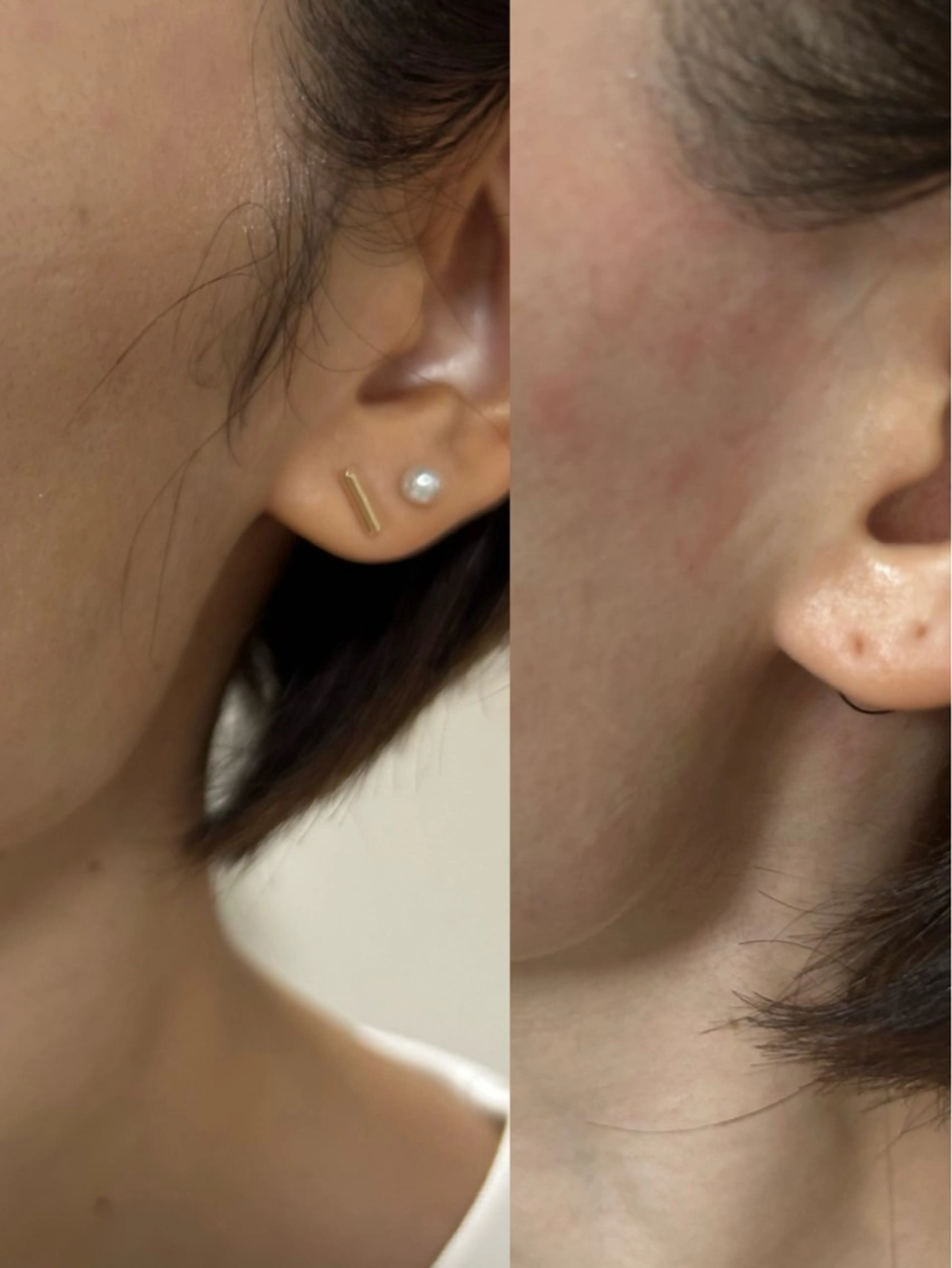 エステ beauty  salon sorelle所属・産毛角質ケア/艶肌 フェイシャルワックスのエステ・リラクイメージ