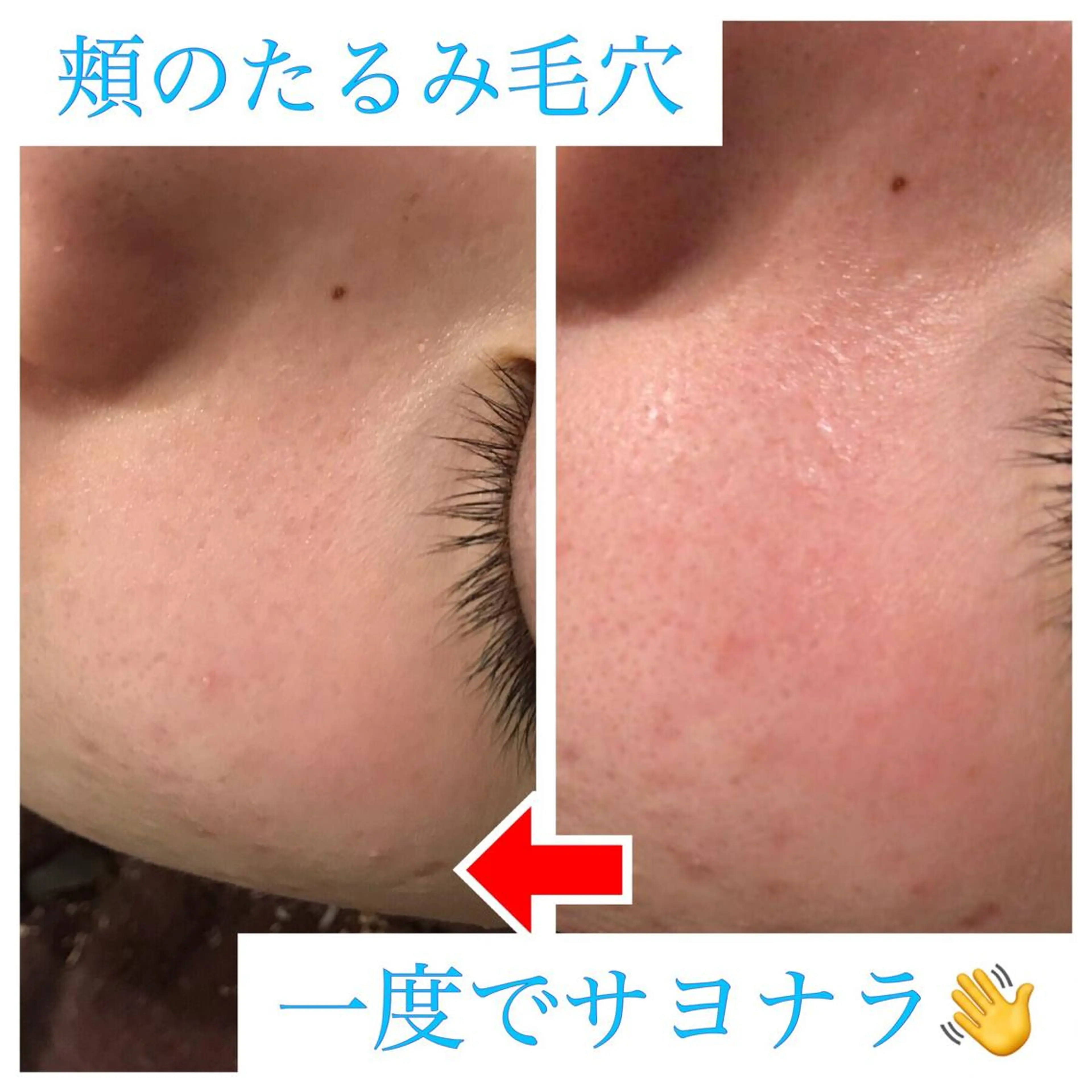 ショート カラー パーマ ヘアアレンジ メンズ キッズ ネイル マツエク・マツパ 金の糸脱毛 産毛ケア専門のエステ・リラクイメージ
