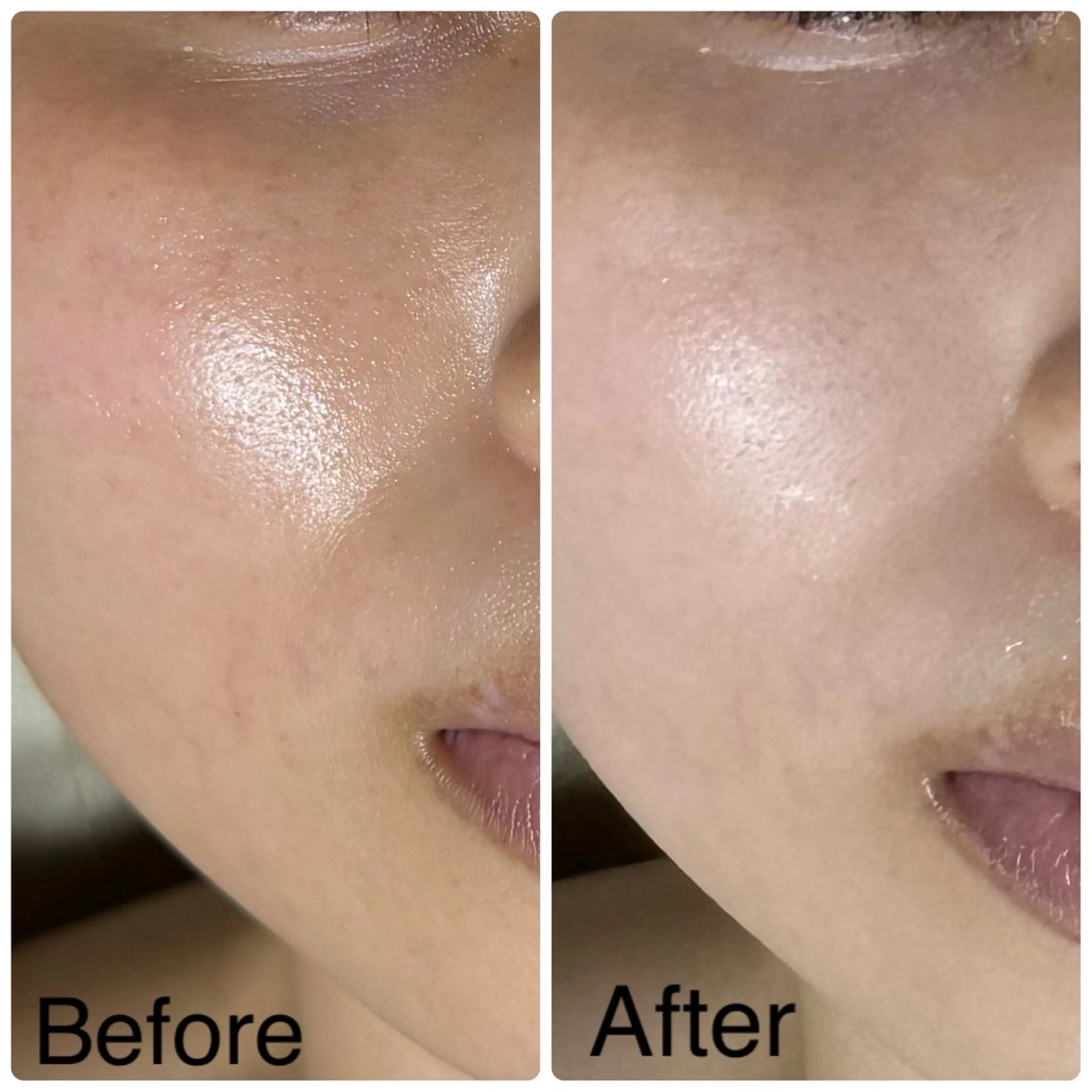 エステ ROR Nanaのエステ・リラクイメージ