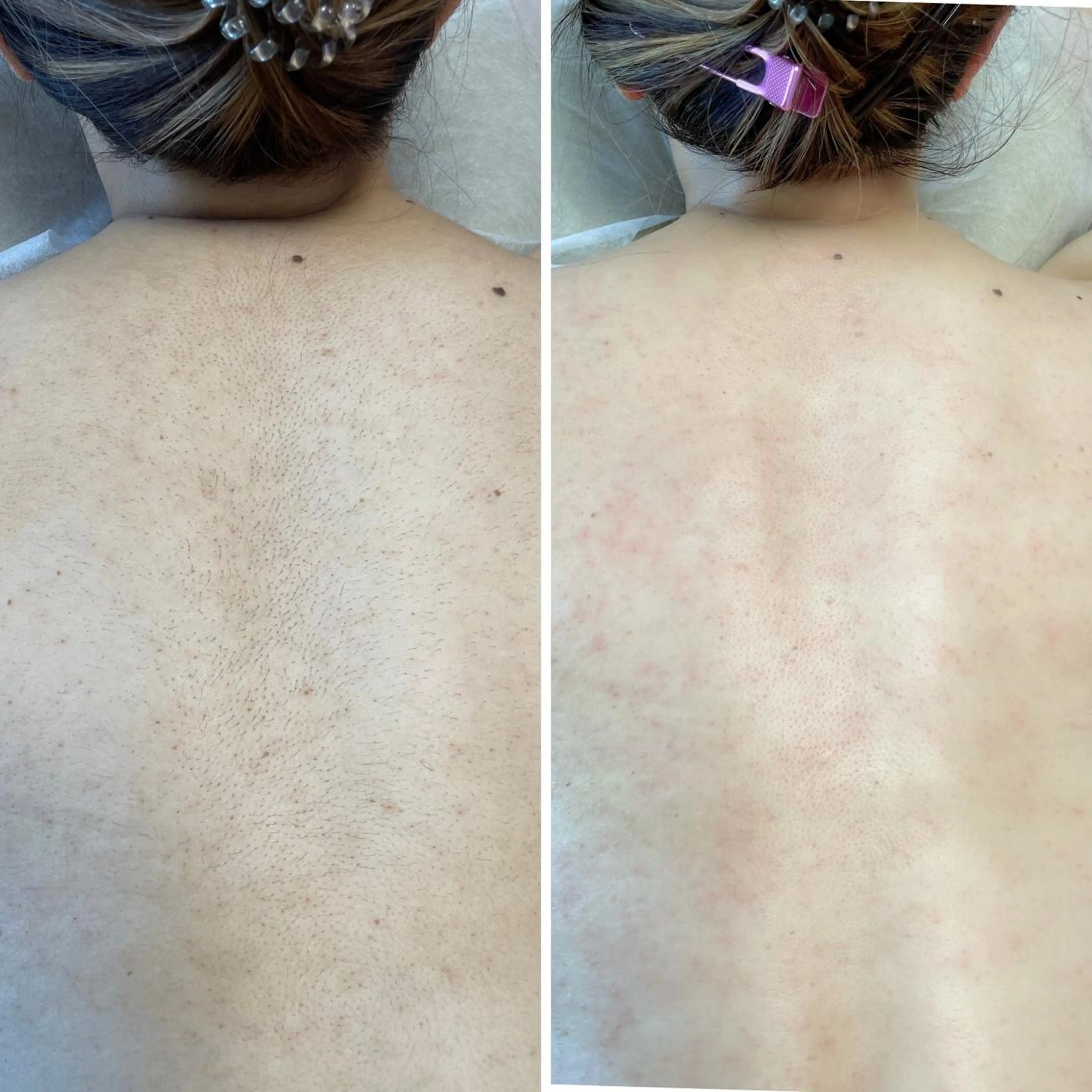 毛穴レス ハーブ＆ ワックス脱毛×光脱毛のエステ・リラクイメージ