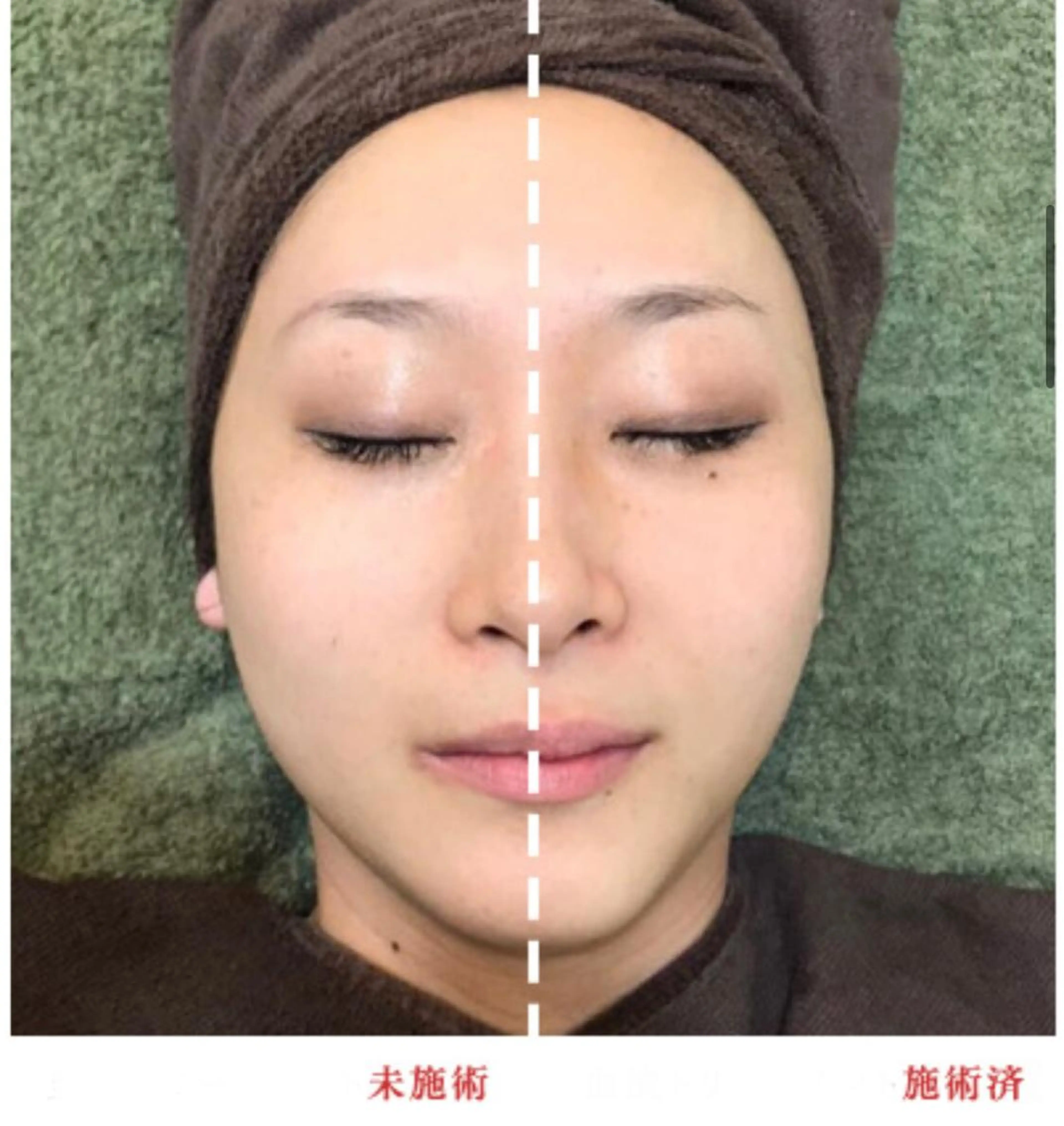 BestBelleꕤ 大阪福島/肌質改善のエステ・リラクイメージ