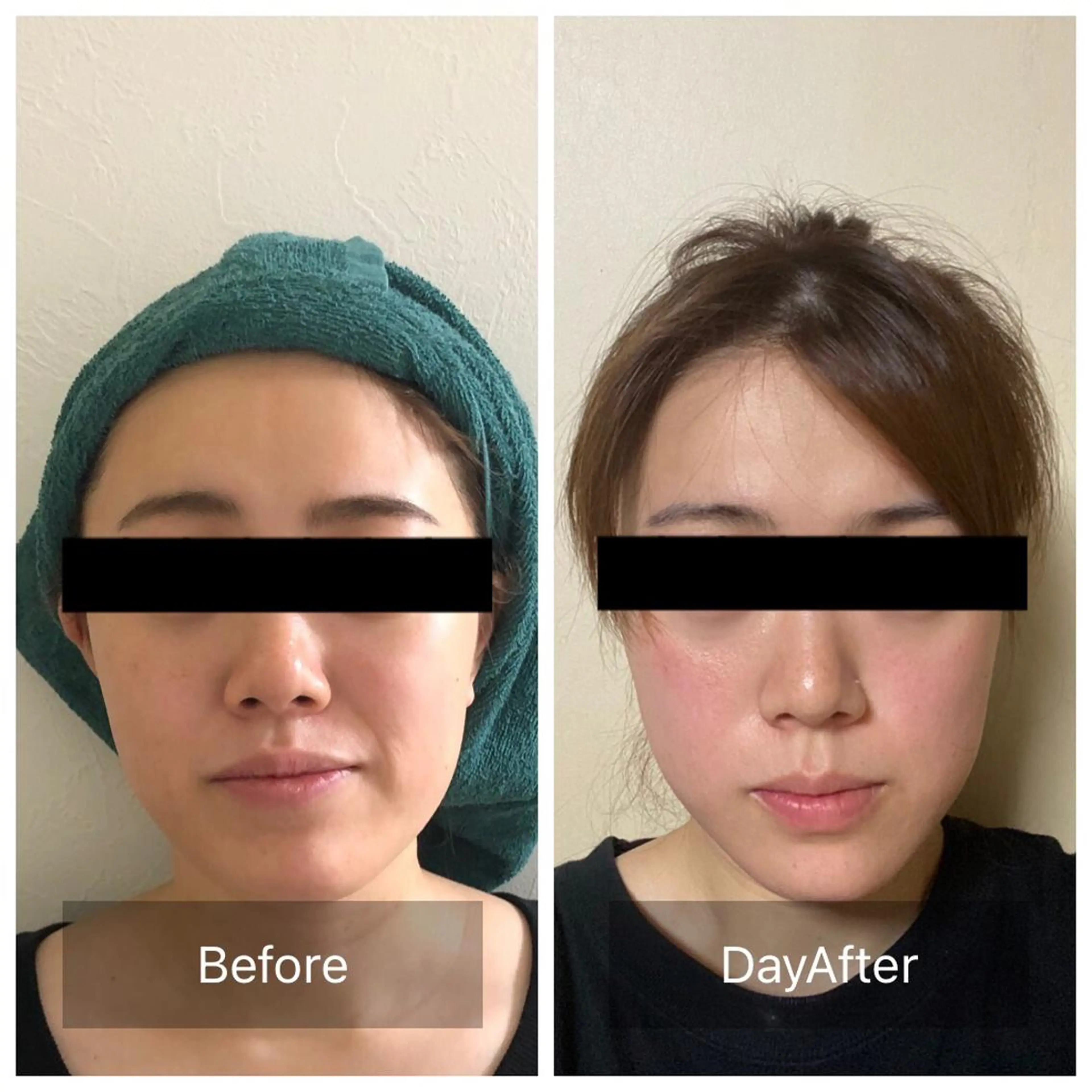 Radiance H.Oのエステ・リラクイメージ