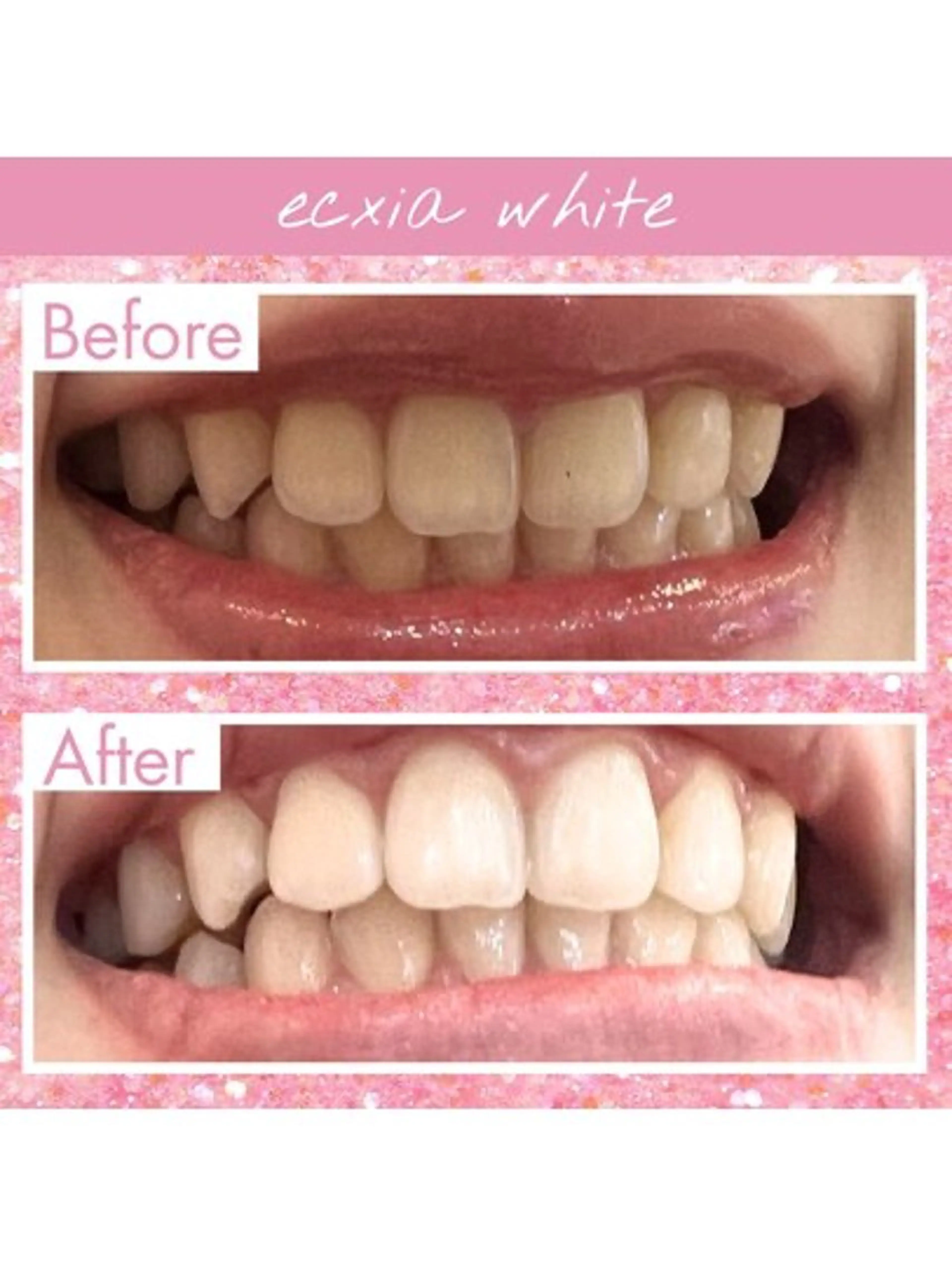 エクシア ホワイトニング西条店のその他イメージ