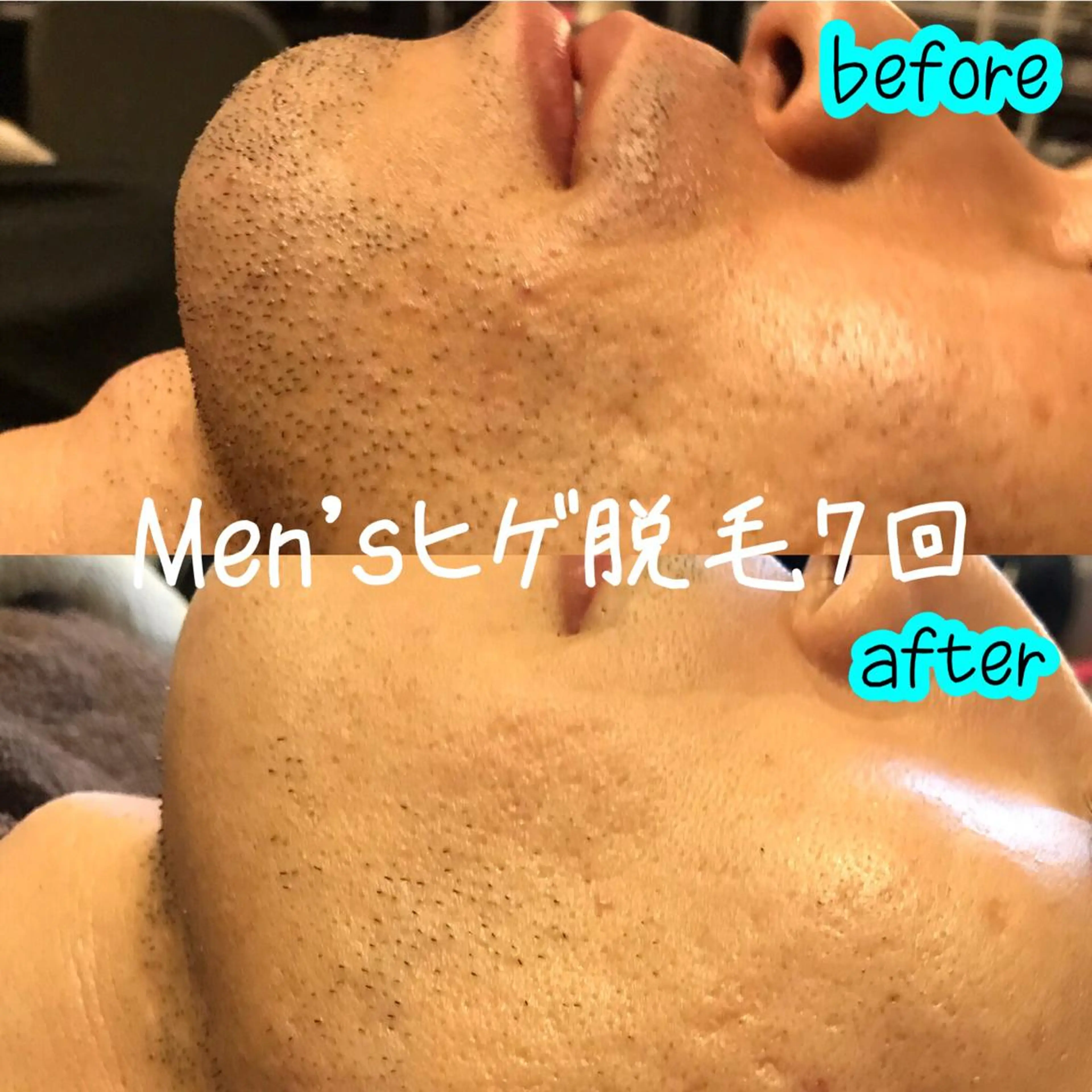 脱毛 浜野 恵美のエステ・リラクイメージ