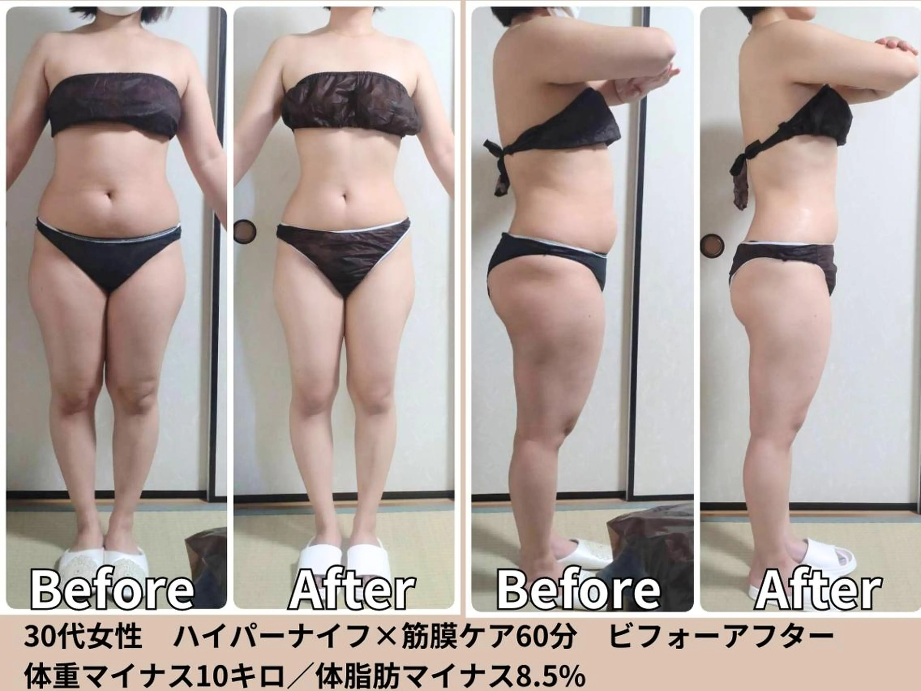 その他 痩身&小顔矯正専門店 Re:Livesのエステ・リラクイメージ