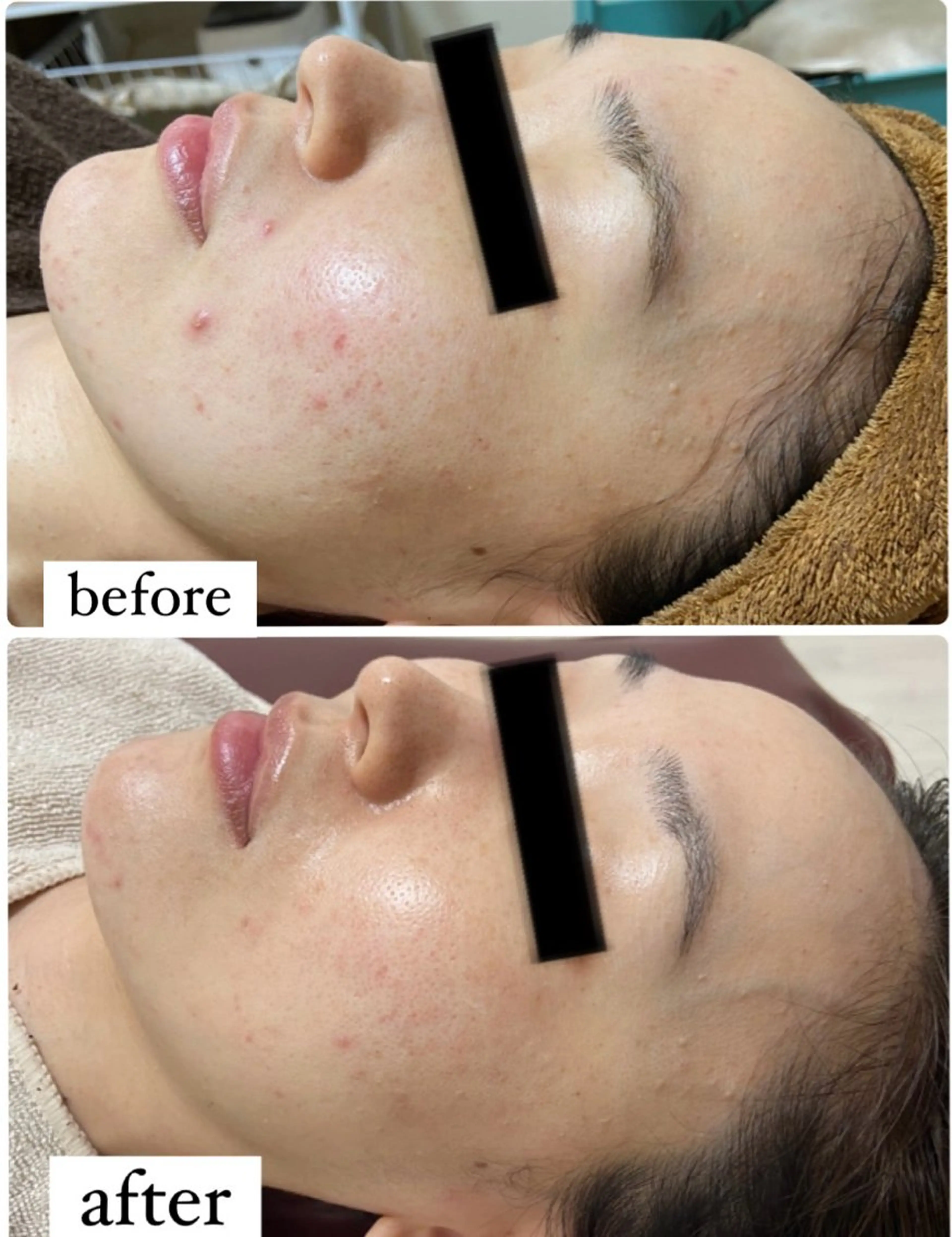 エステ REBORN by ami-goのその他イメージ