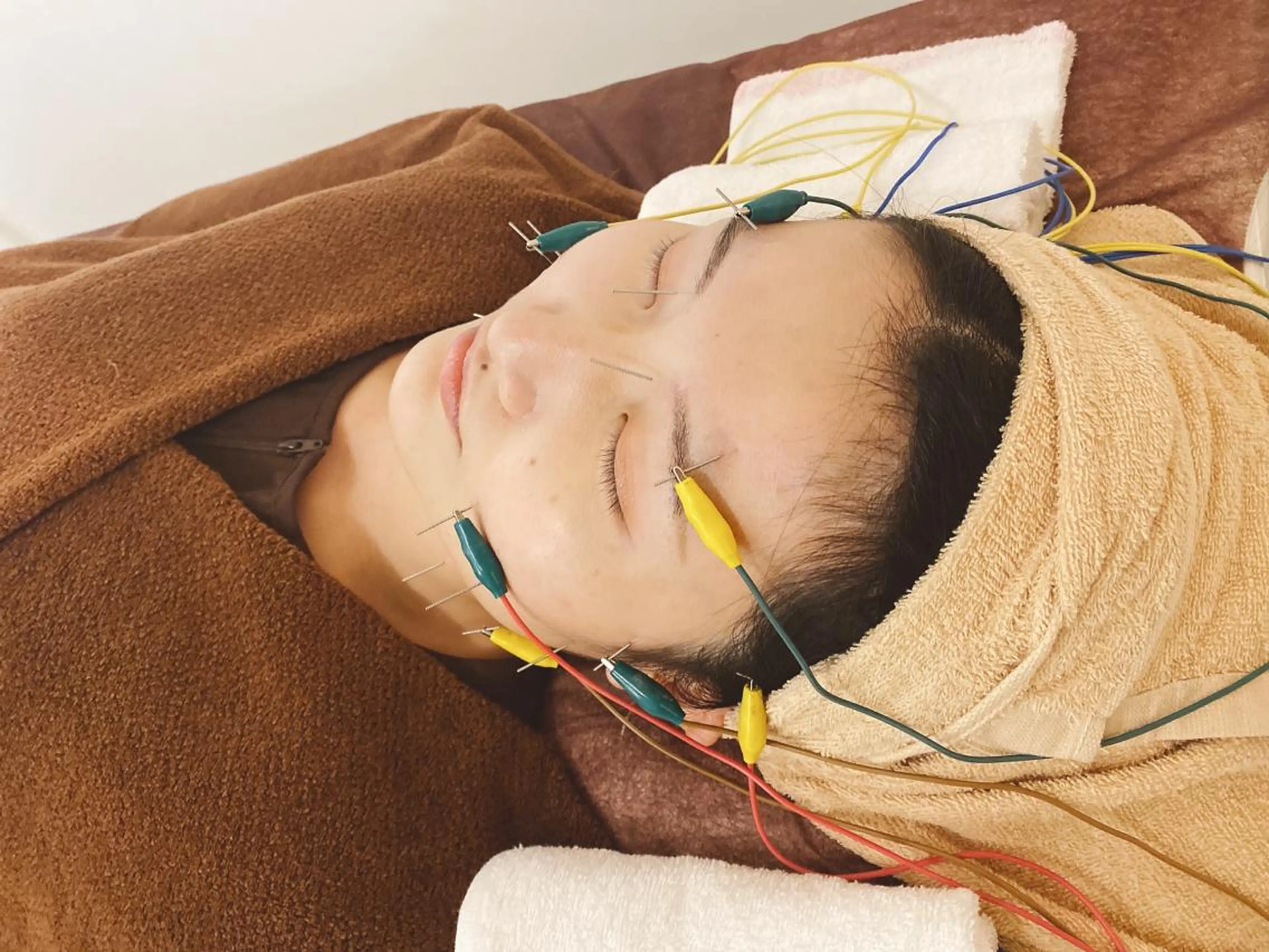 小顔矯正・美容鍼 美鍼堂のエステ・リラクイメージ