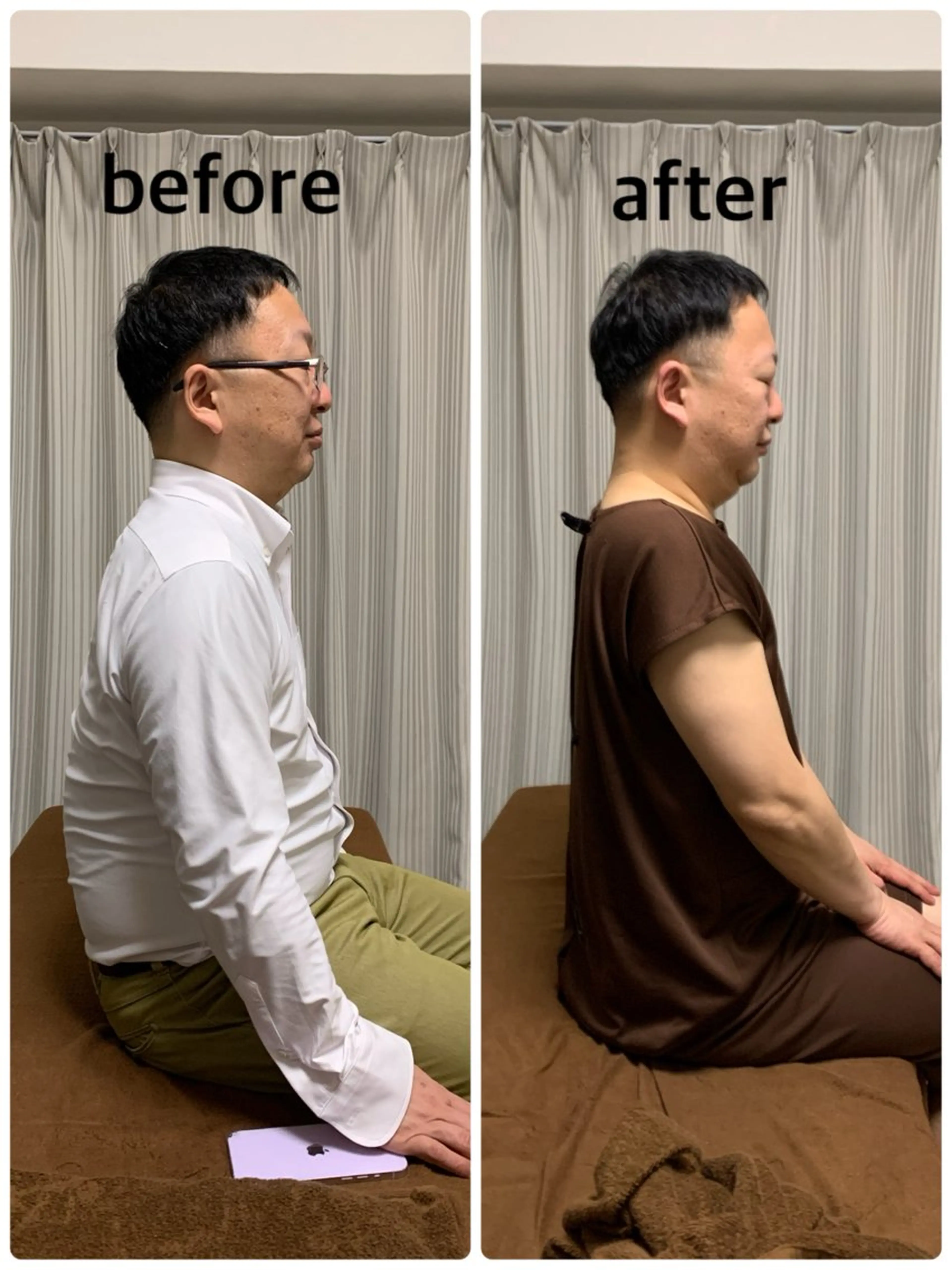 骨盤矯正、O脚矯正の写真