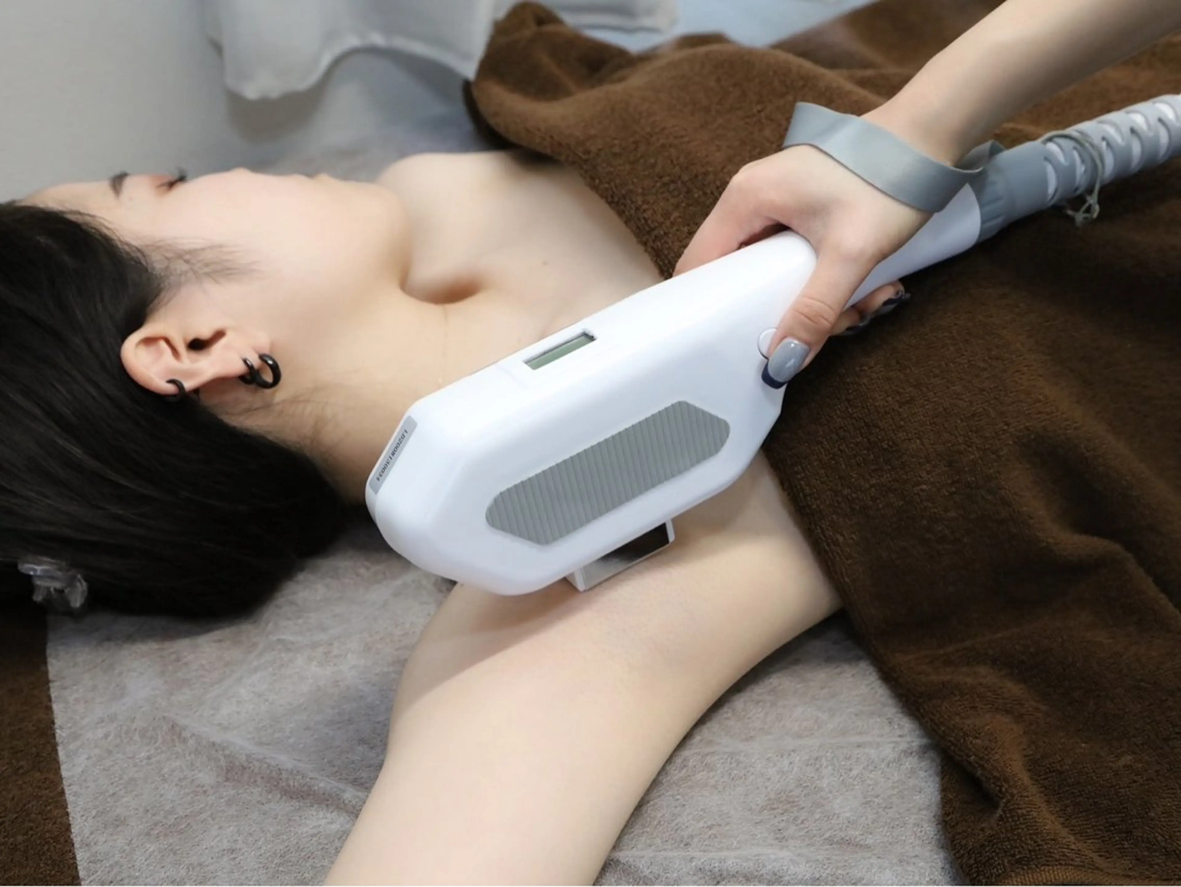 脱毛 ENCHANT Kaede/肌質改善のその他イメージ