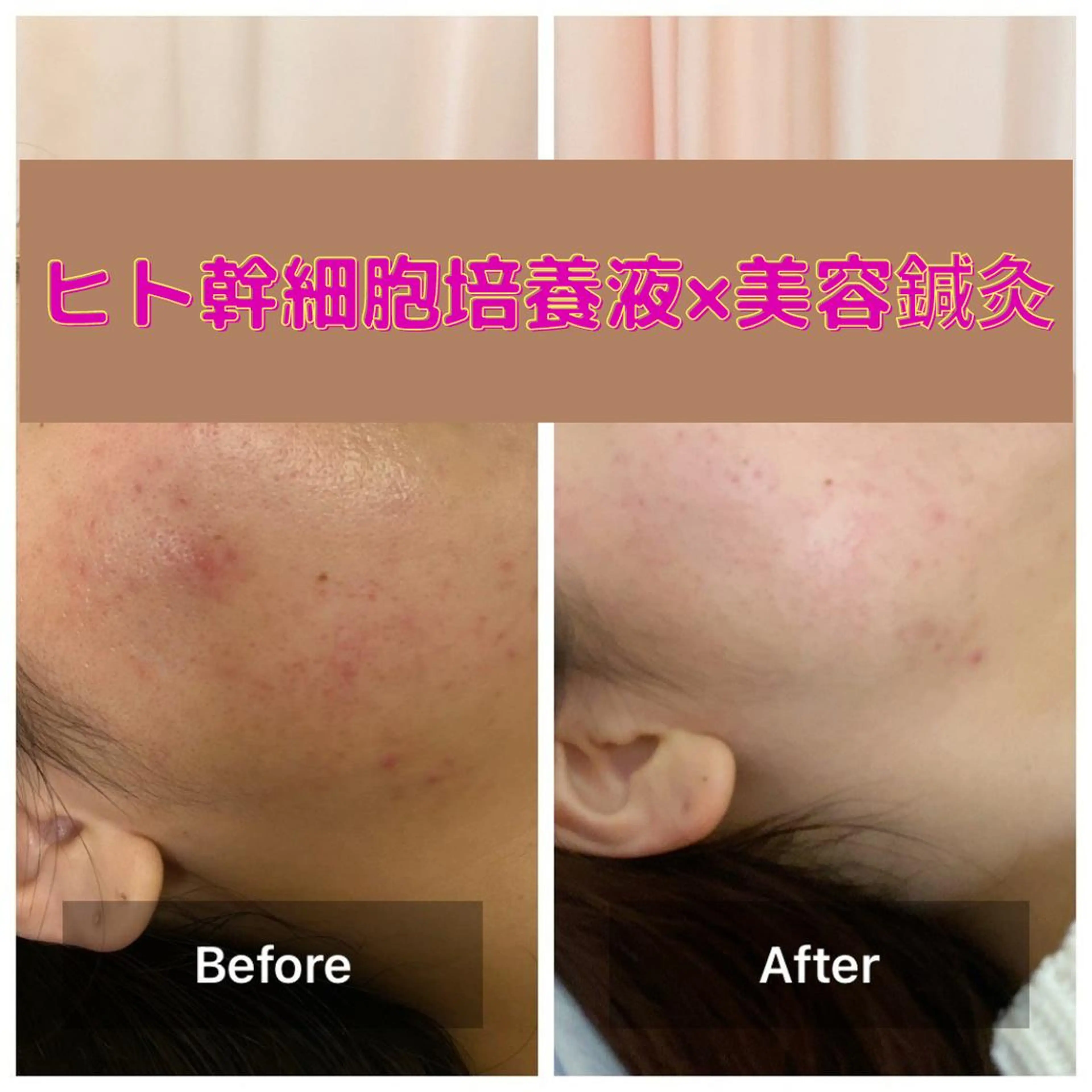 エステ gomi sayakaのエステ・リラクイメージ