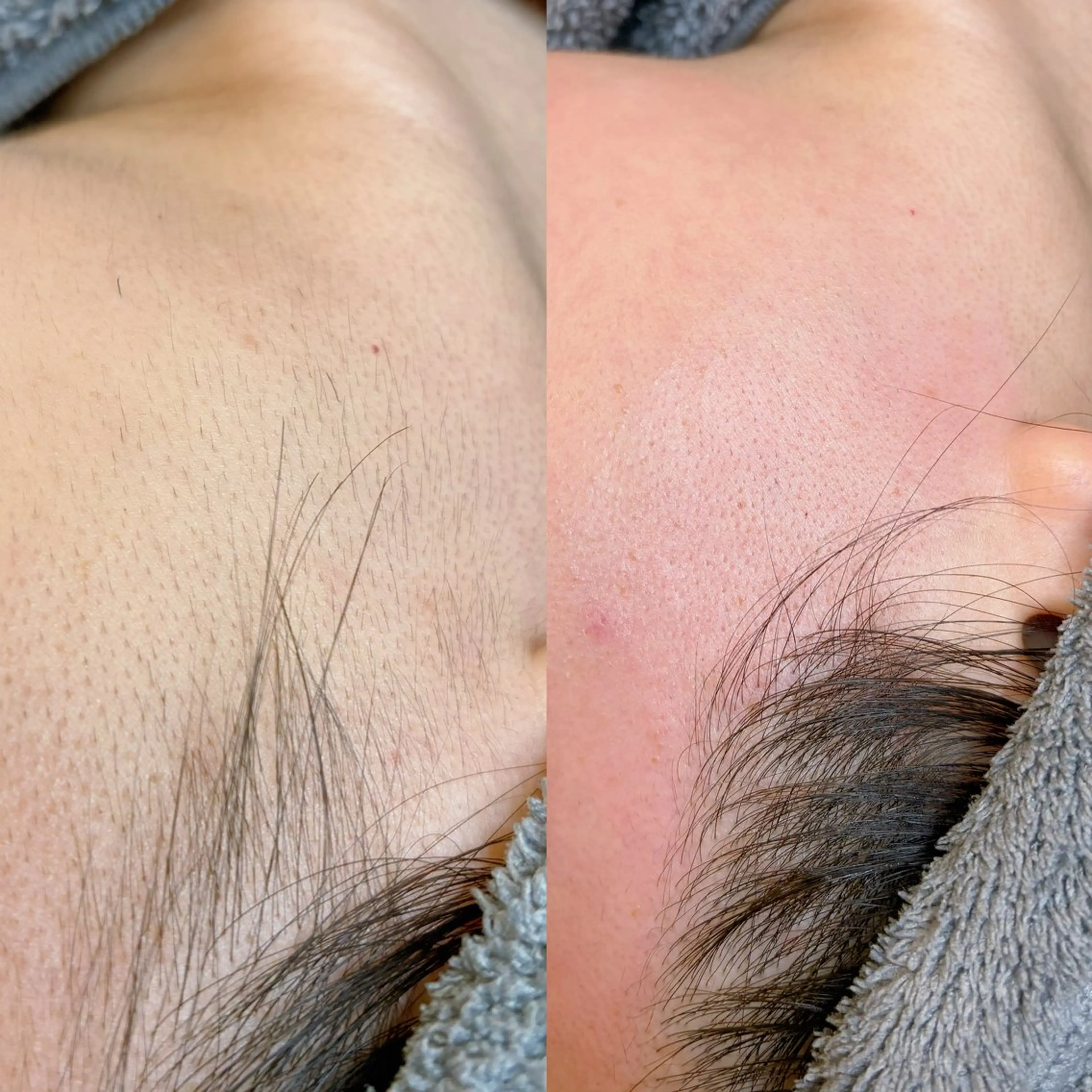 脱毛 佐々木 ちゆきのエステ・リラクイメージ