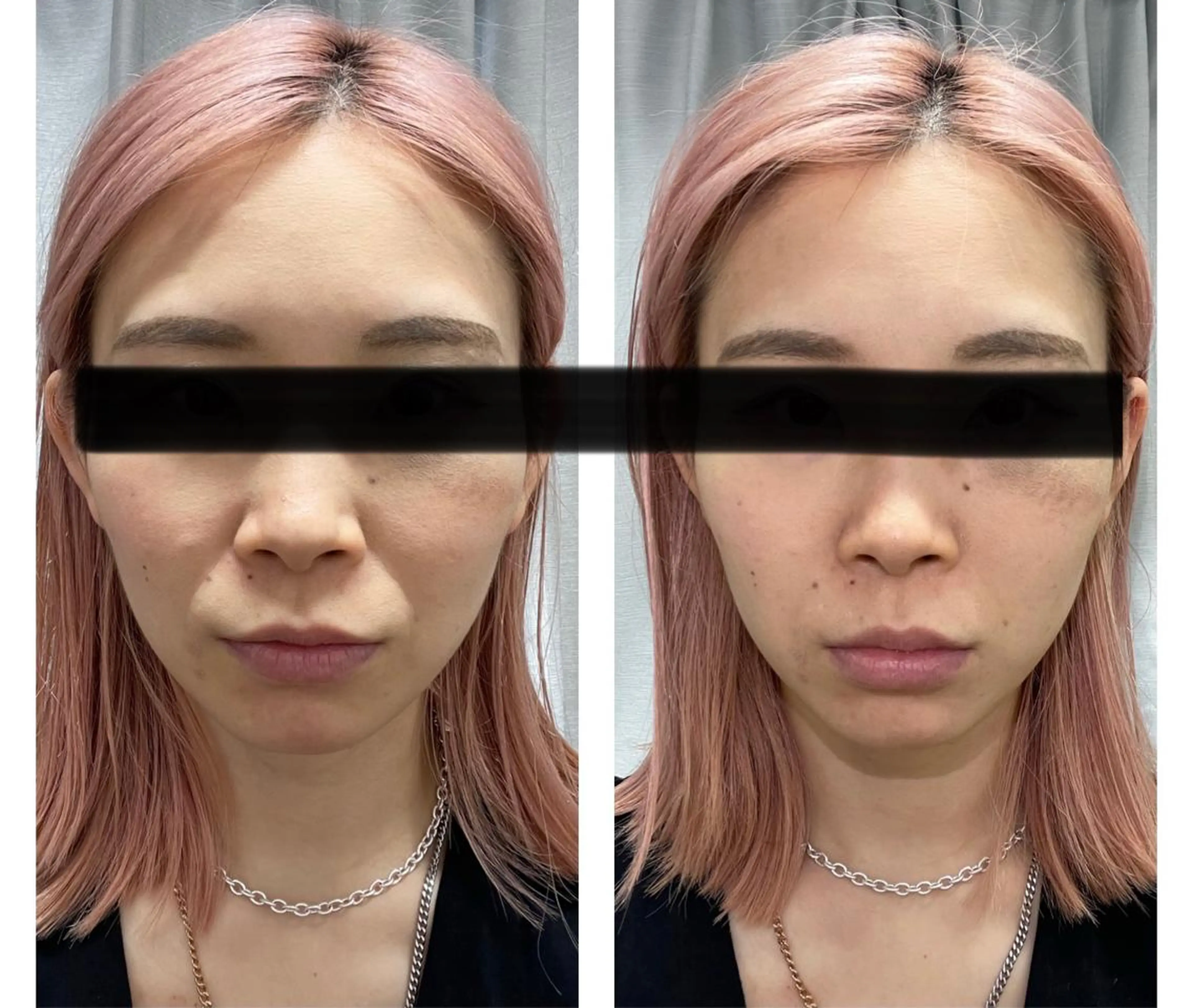 ENCHANT 脱毛.小顔.毛穴のエステ・リラクイメージ