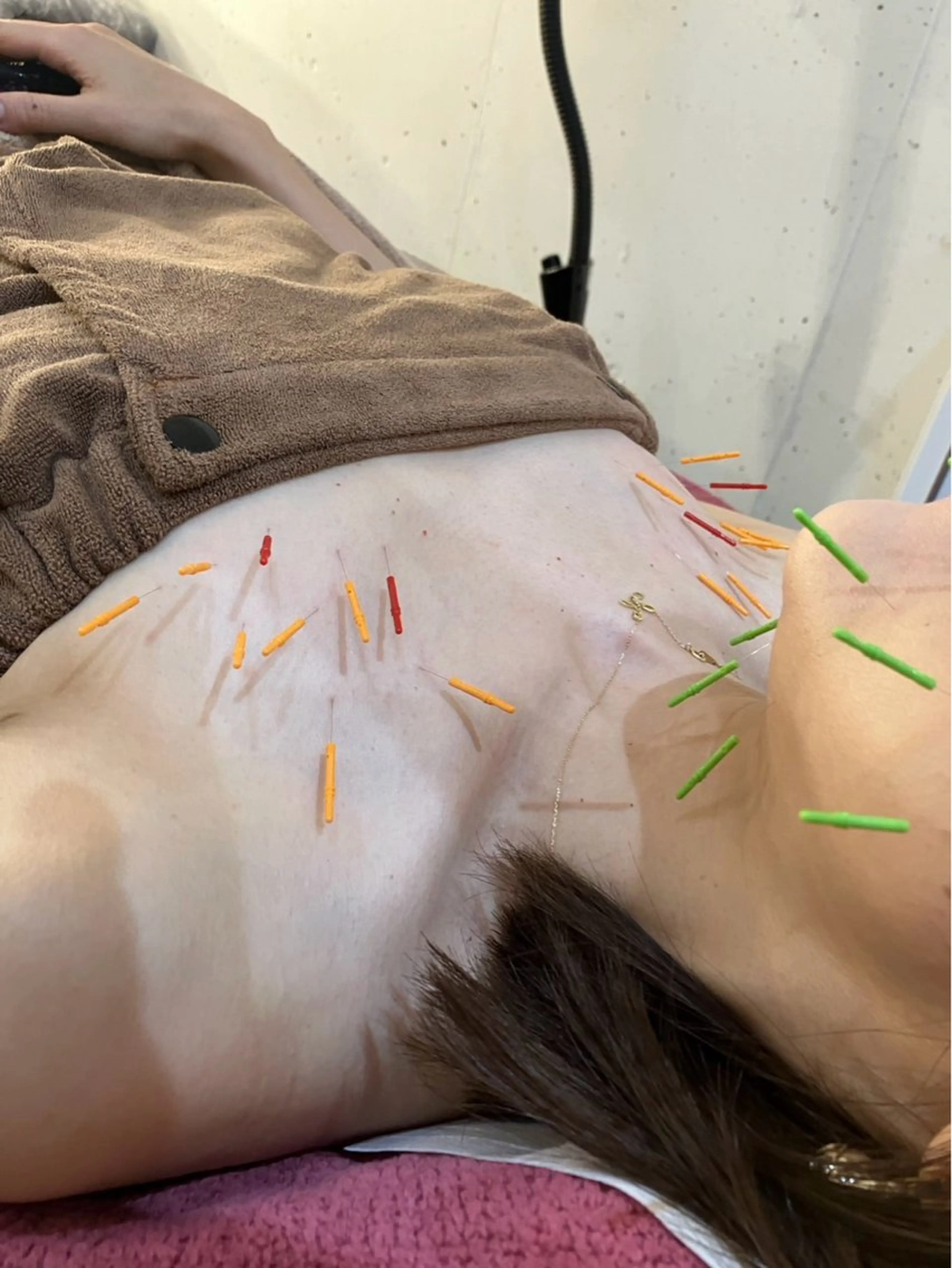 その他 美容鍼灸女性専用 りんご鍼灸治療院のその他イメージ