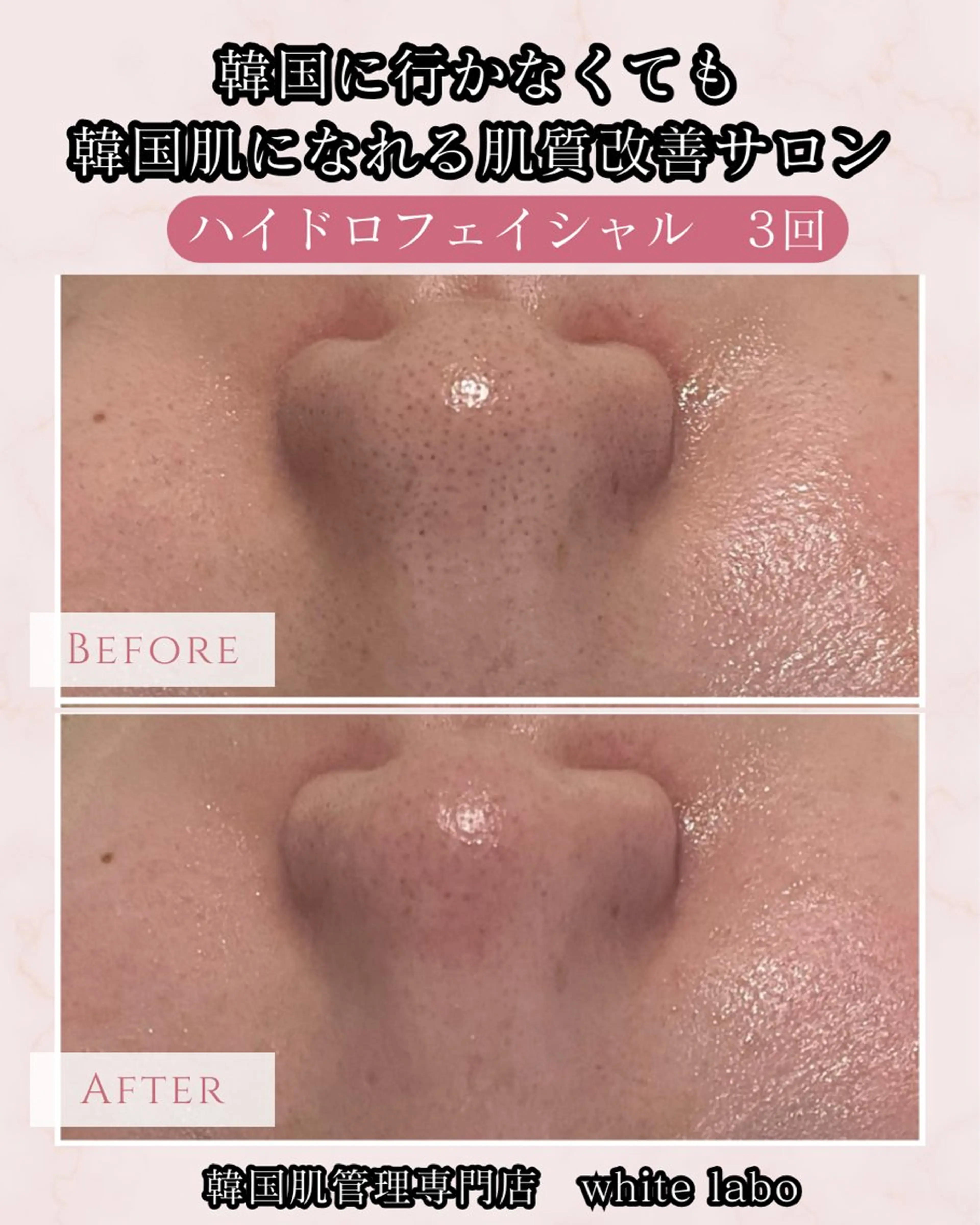 韓国肌管理専門店　White labo 梅田店所属・ホワイトラボ梅田 ｜毛穴・韓国肌管理のエステ・リラクイメージ