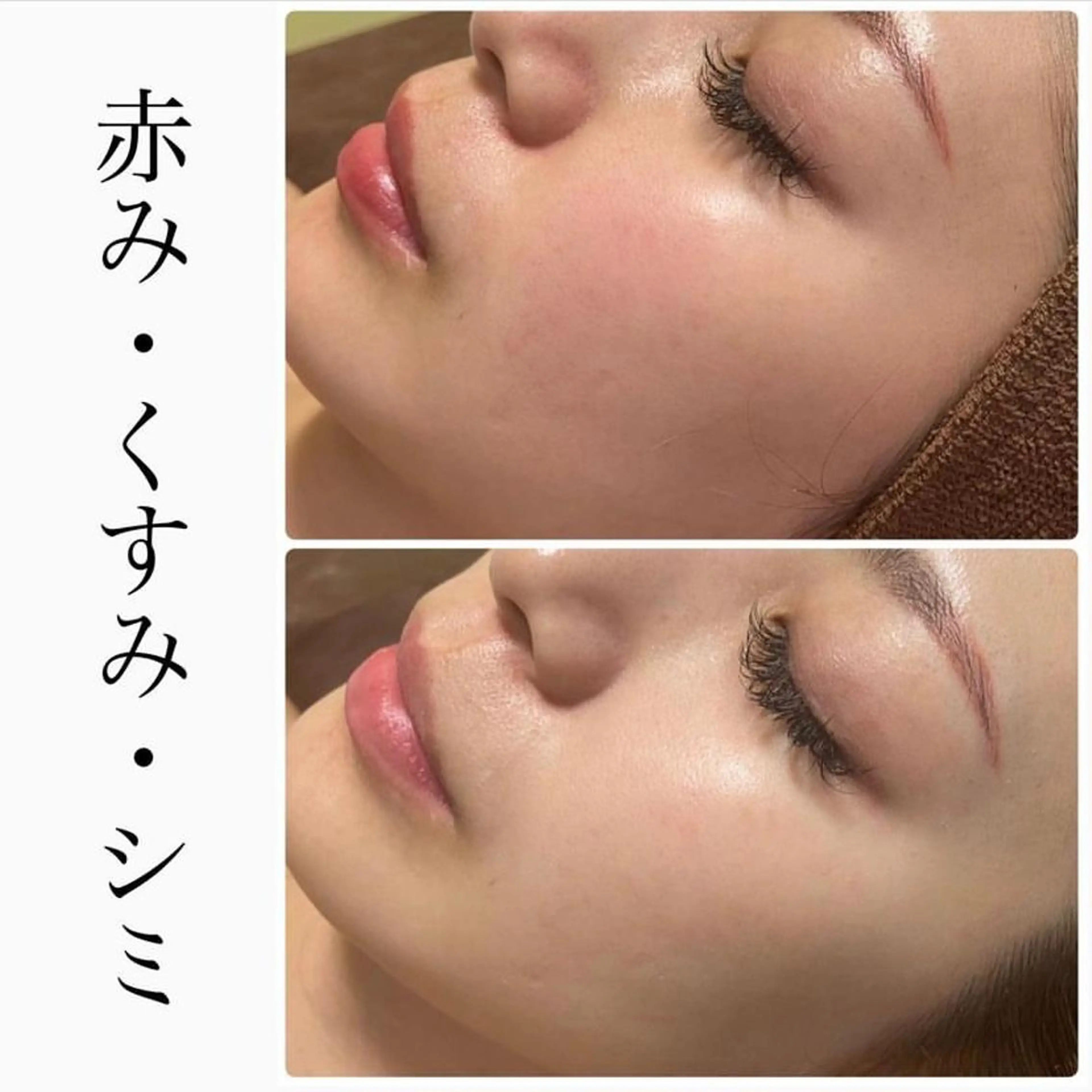 エステ ハーブピーリング専門 BIOPLUS＋川崎のエステ・リラクイメージ