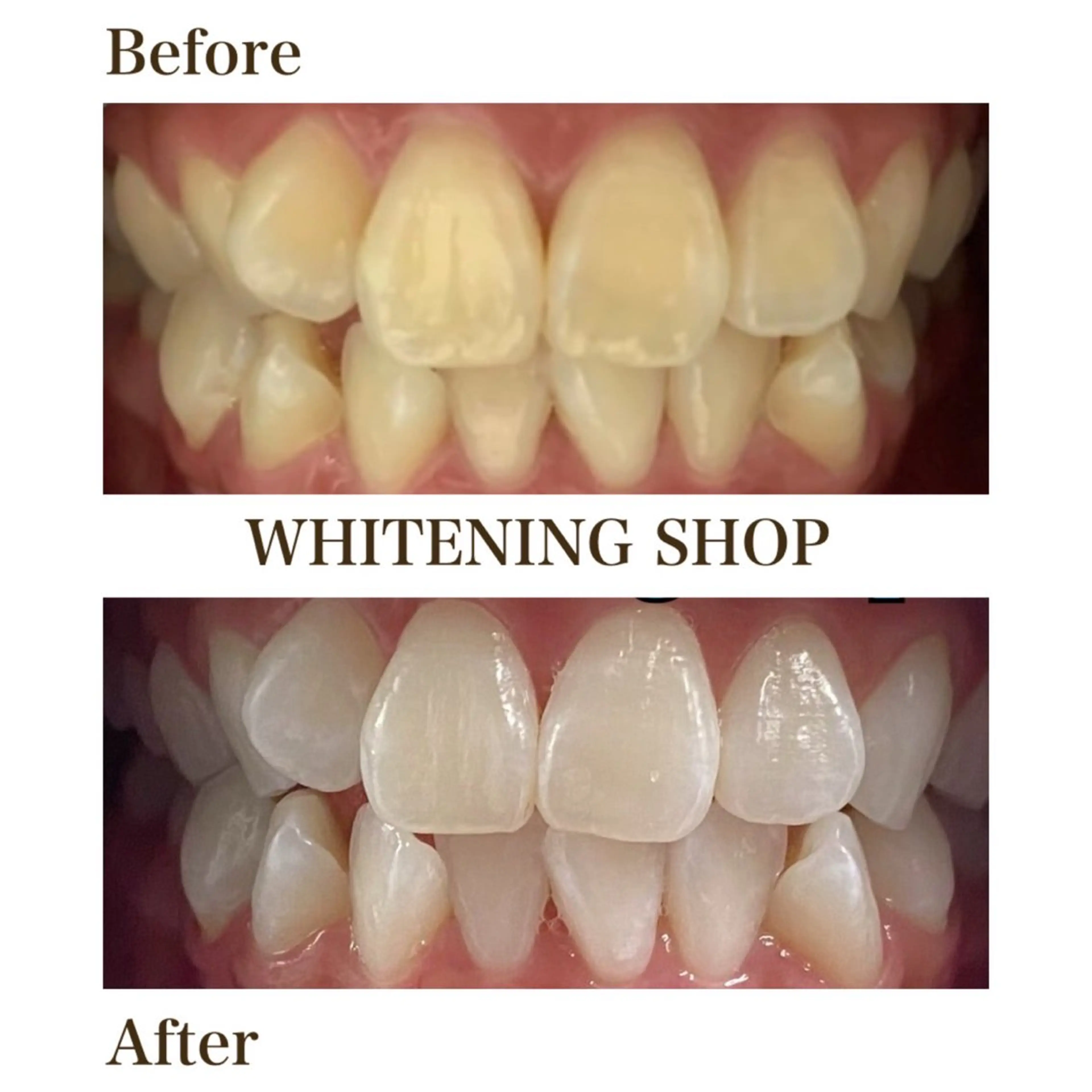 メンズ エステ リラク ホワイトニング ショップ川越店のエステ・リラクイメージ