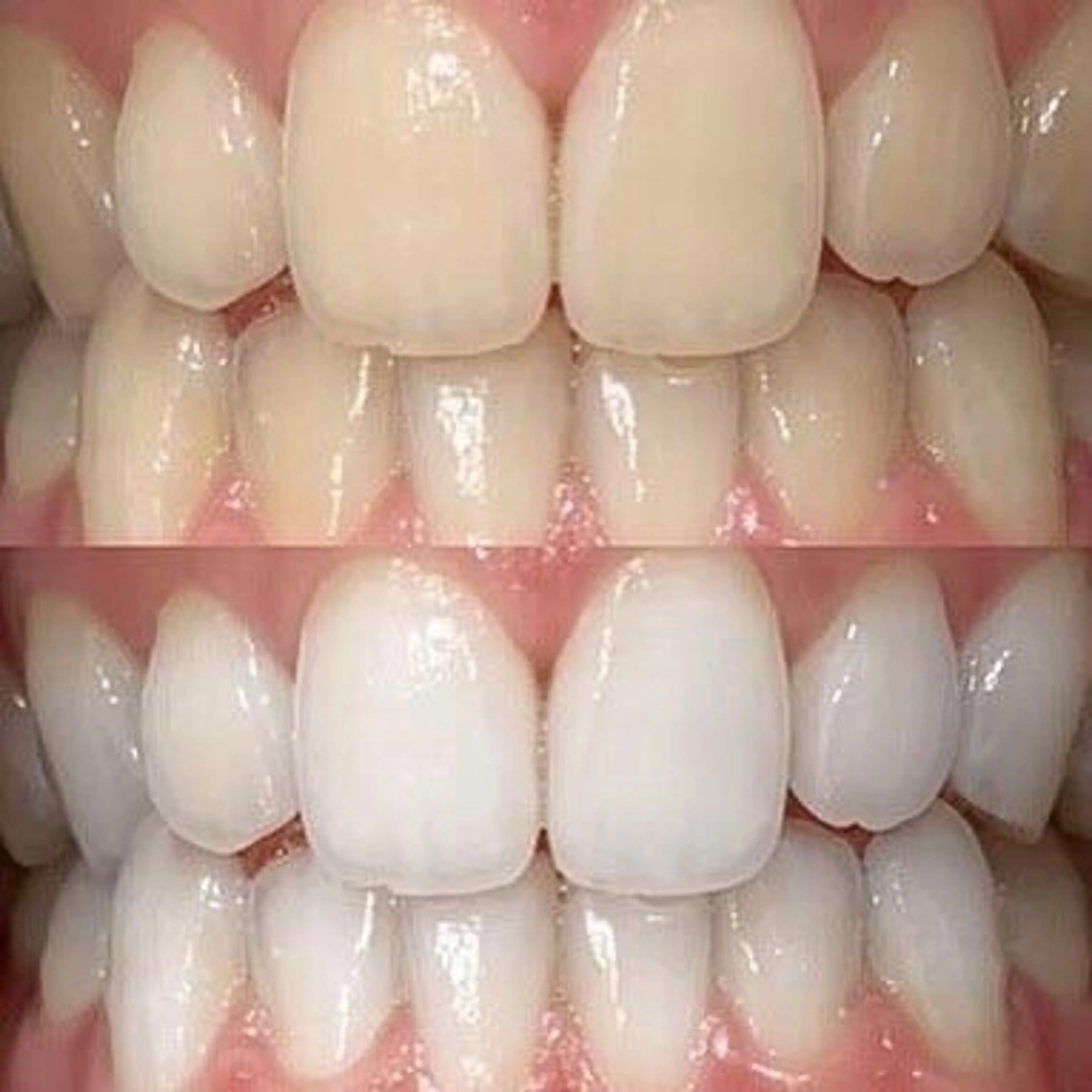 歯のホワイトニング専門店＆white所属・歯のホワイトニング 専門店&whiteのその他イメージ