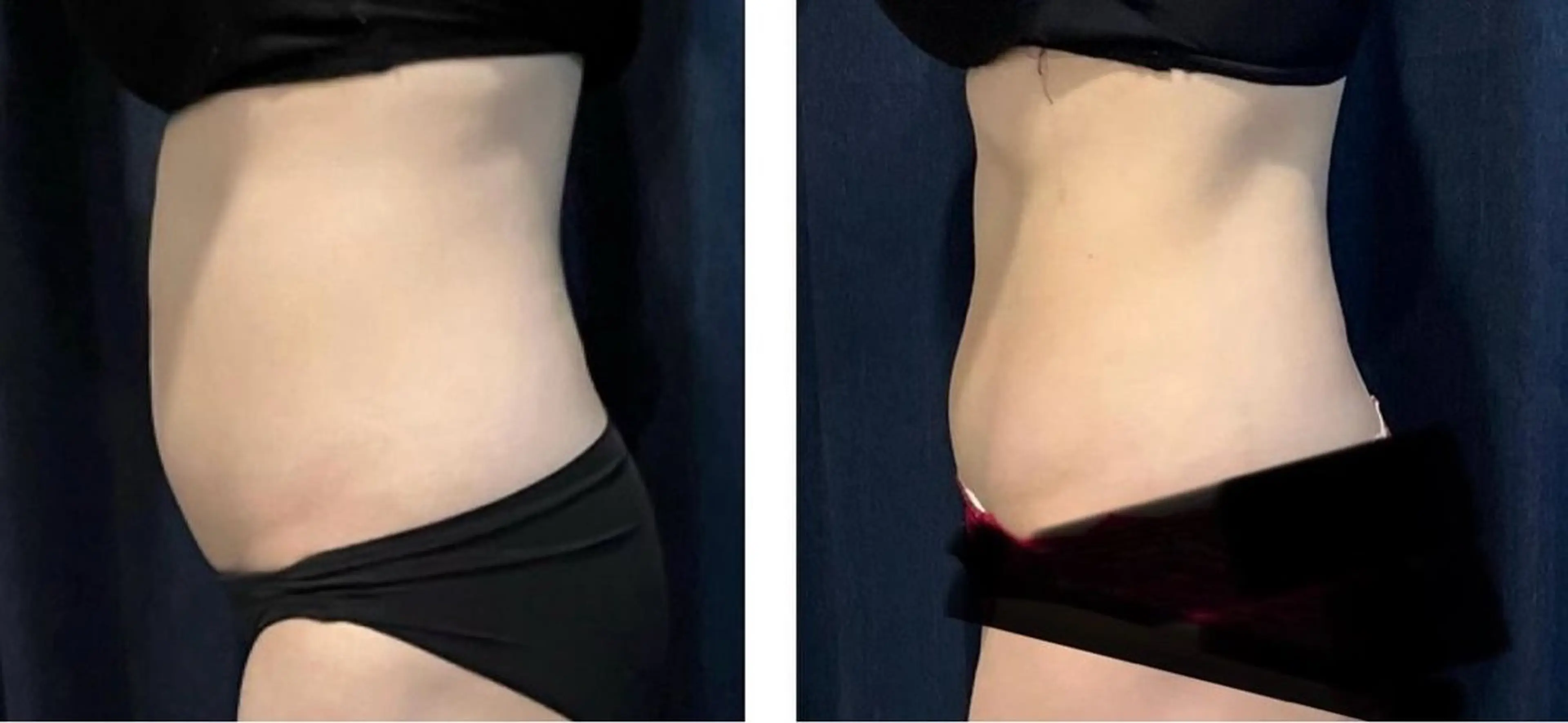 marrina terraceのエステ・リラクイメージ