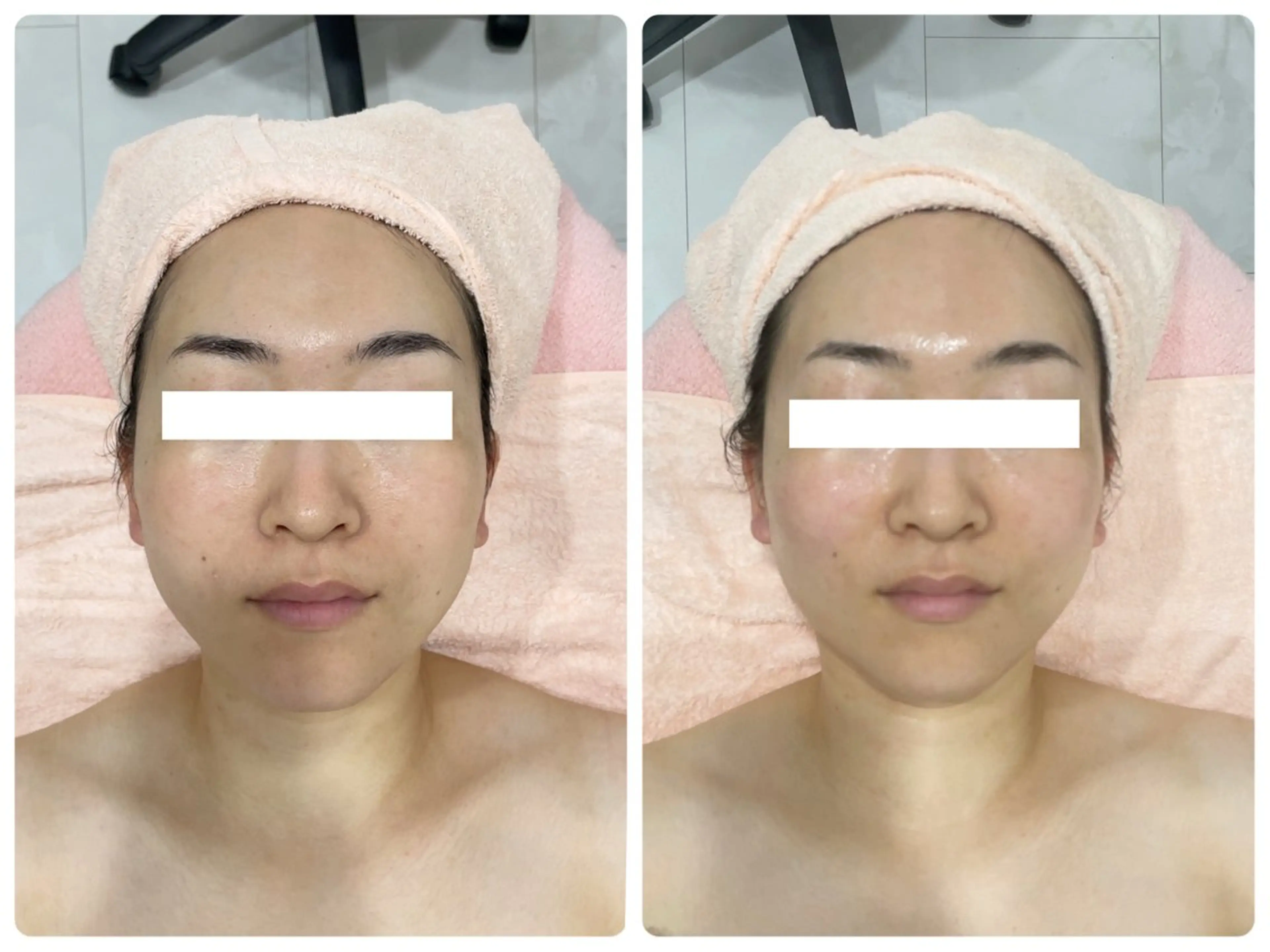 エステ 本格派エステ ハピスリーのエステ・リラクイメージ