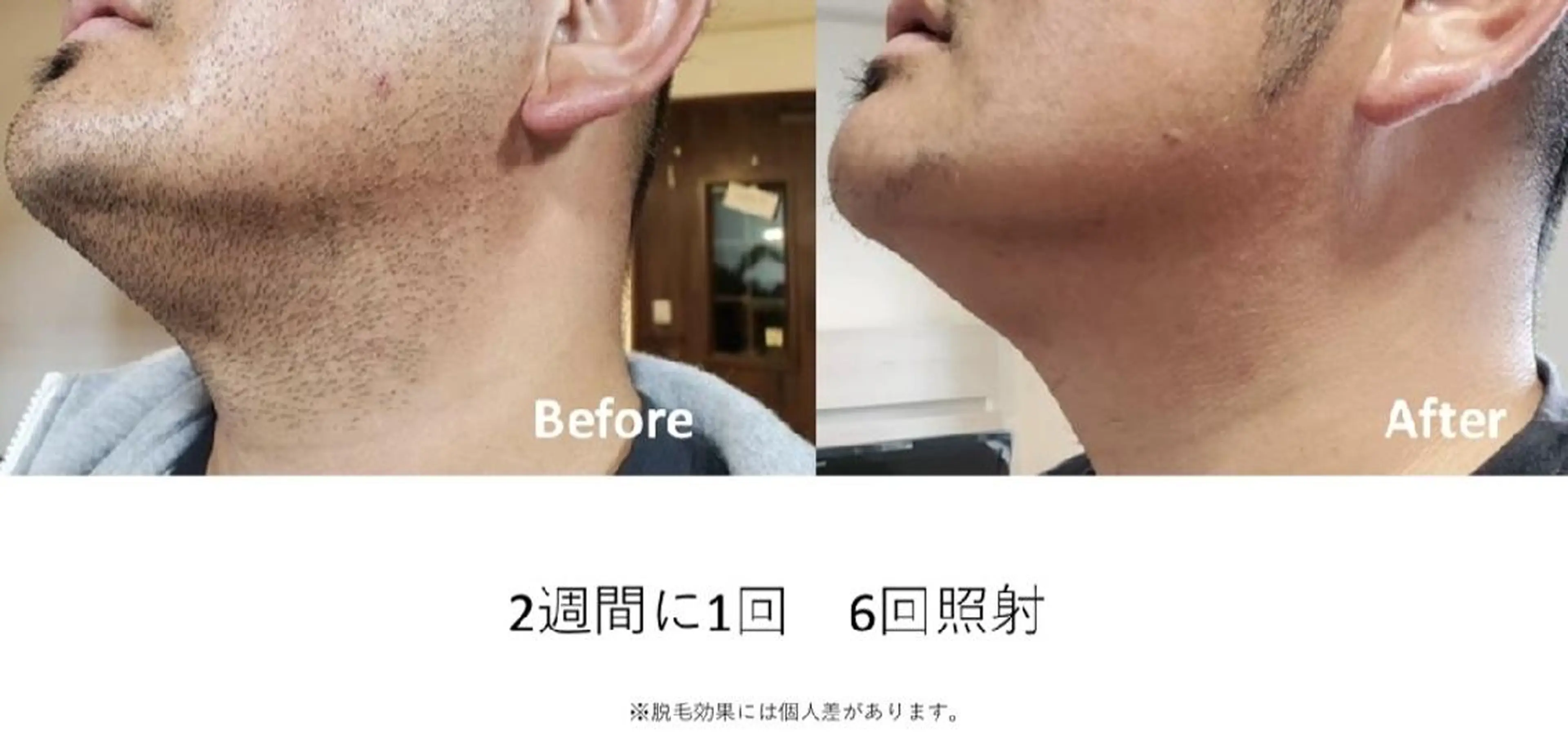 メンズ 脱毛 プライベートサロン シャルムのその他イメージ