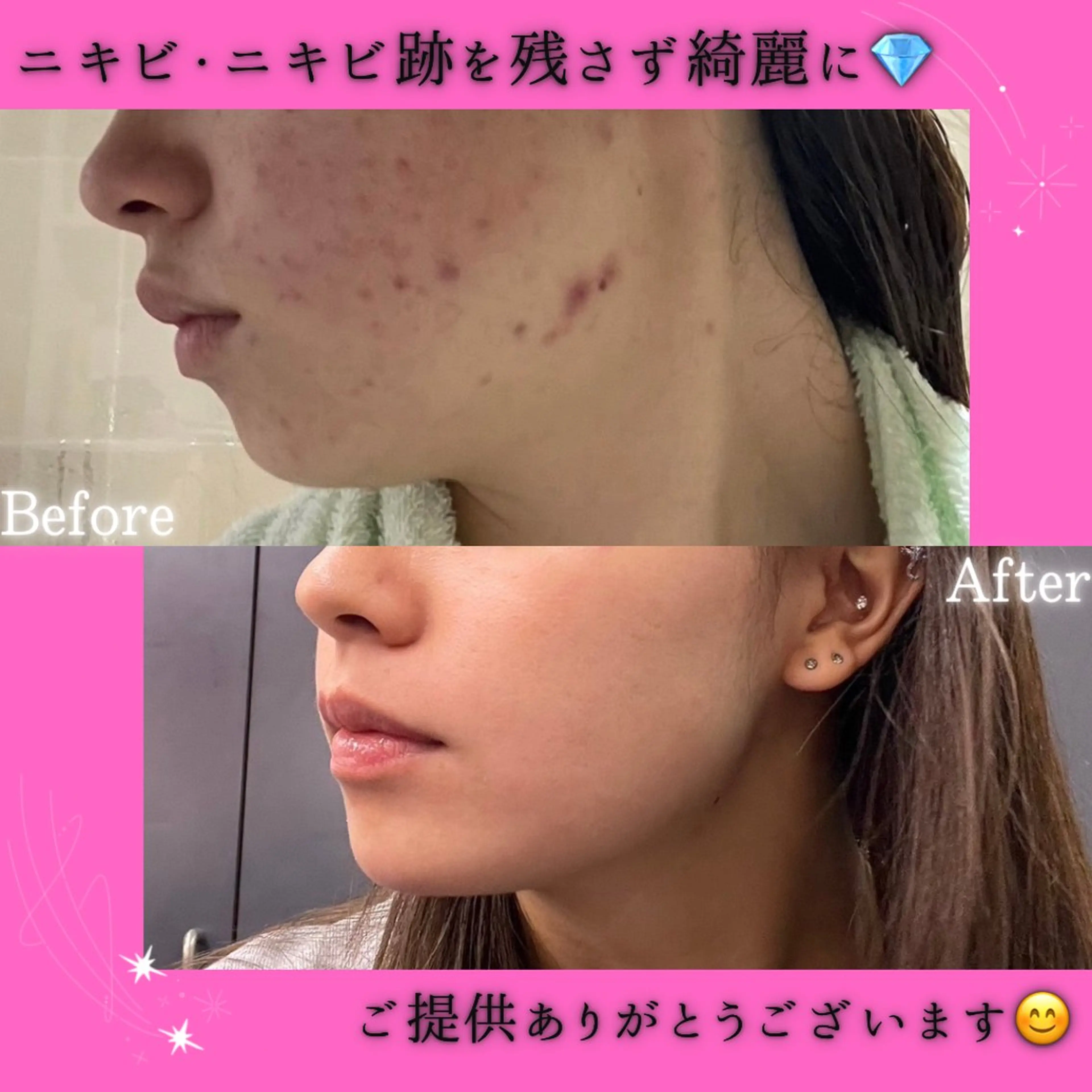 エステ リラク 痩身&美肌サロン 堀米✨のその他イメージ