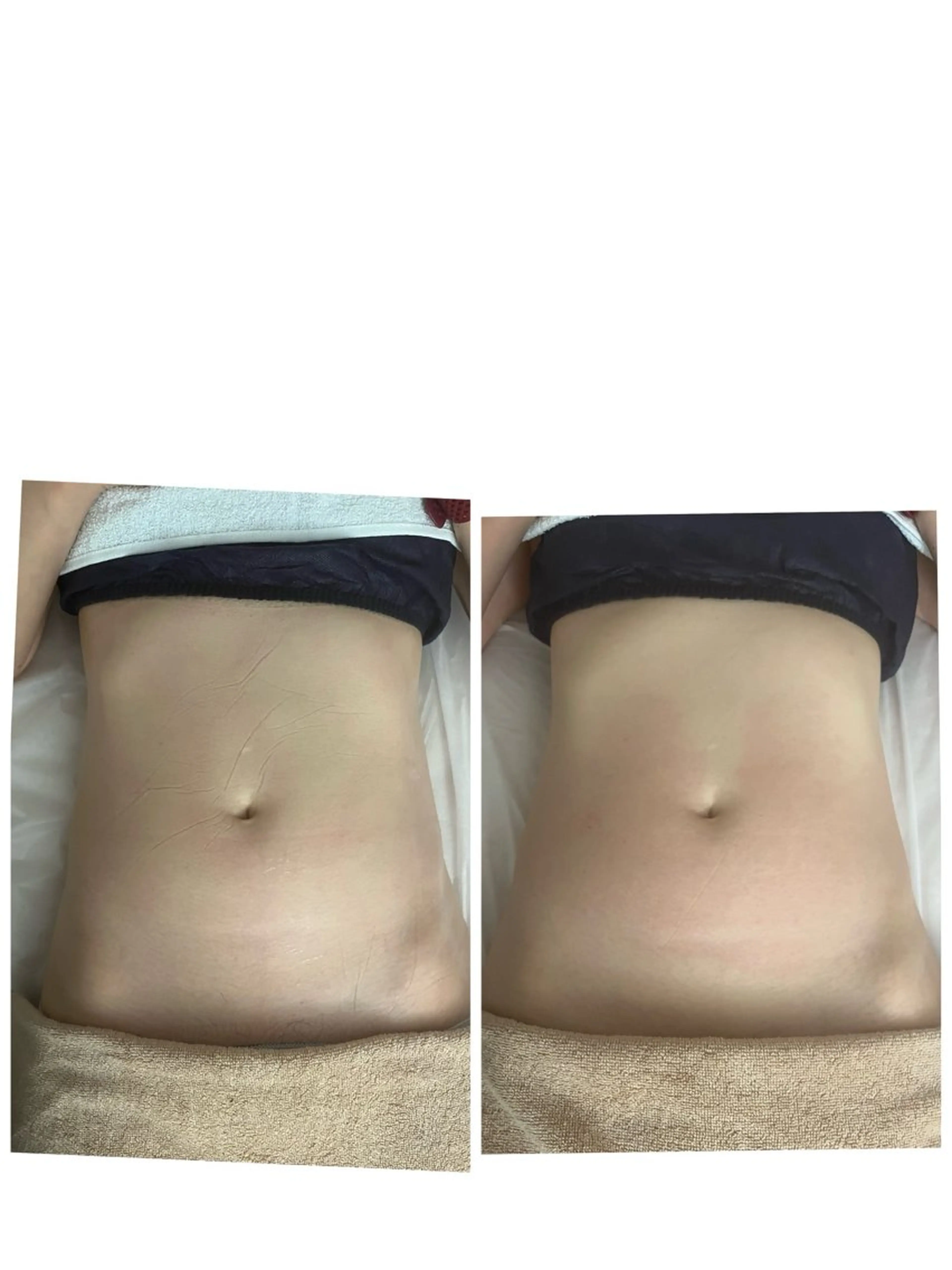 美肌＆痩身＆脱毛 MANAのエステ・リラクイメージ