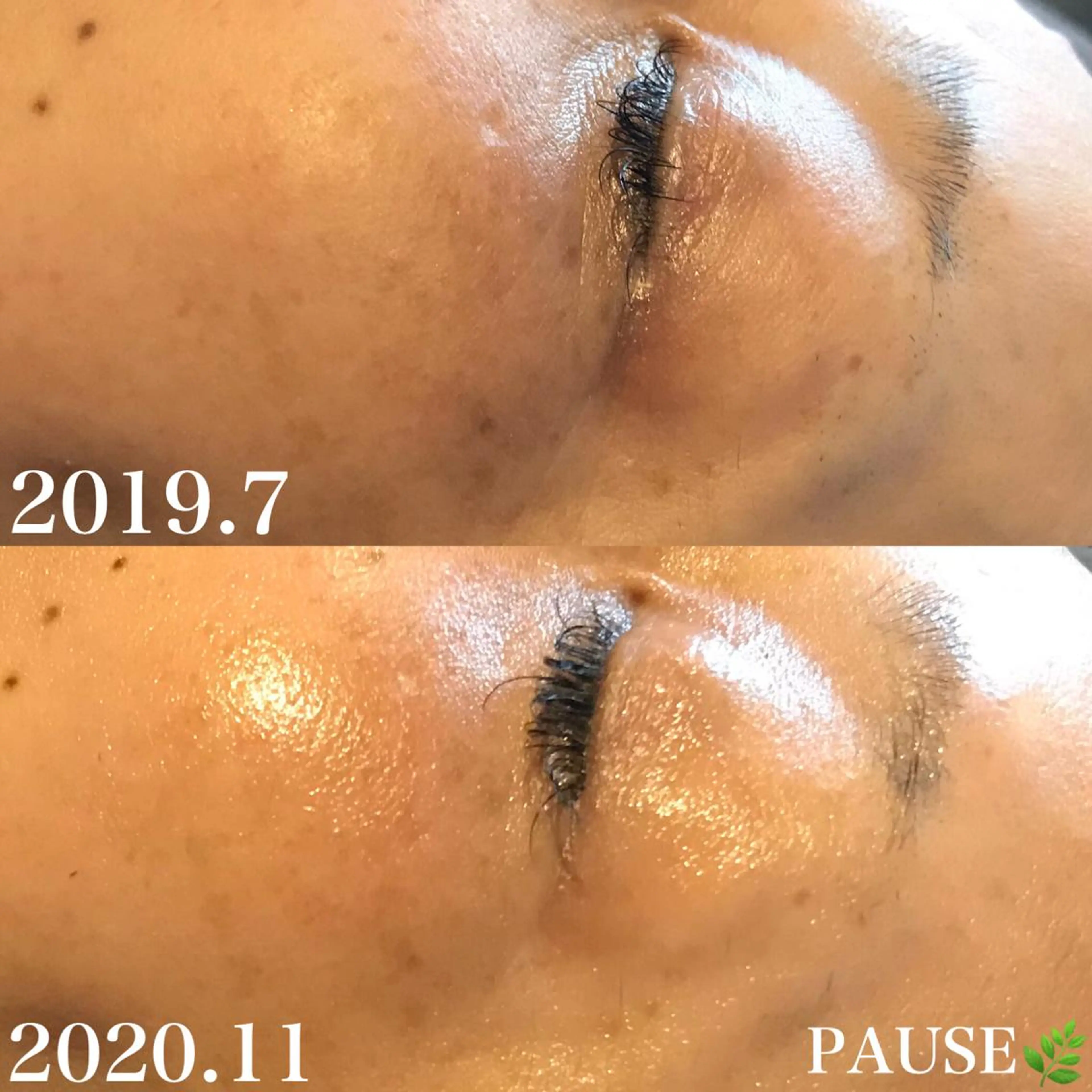 エステ 浜野 恵美のエステ・リラクイメージ