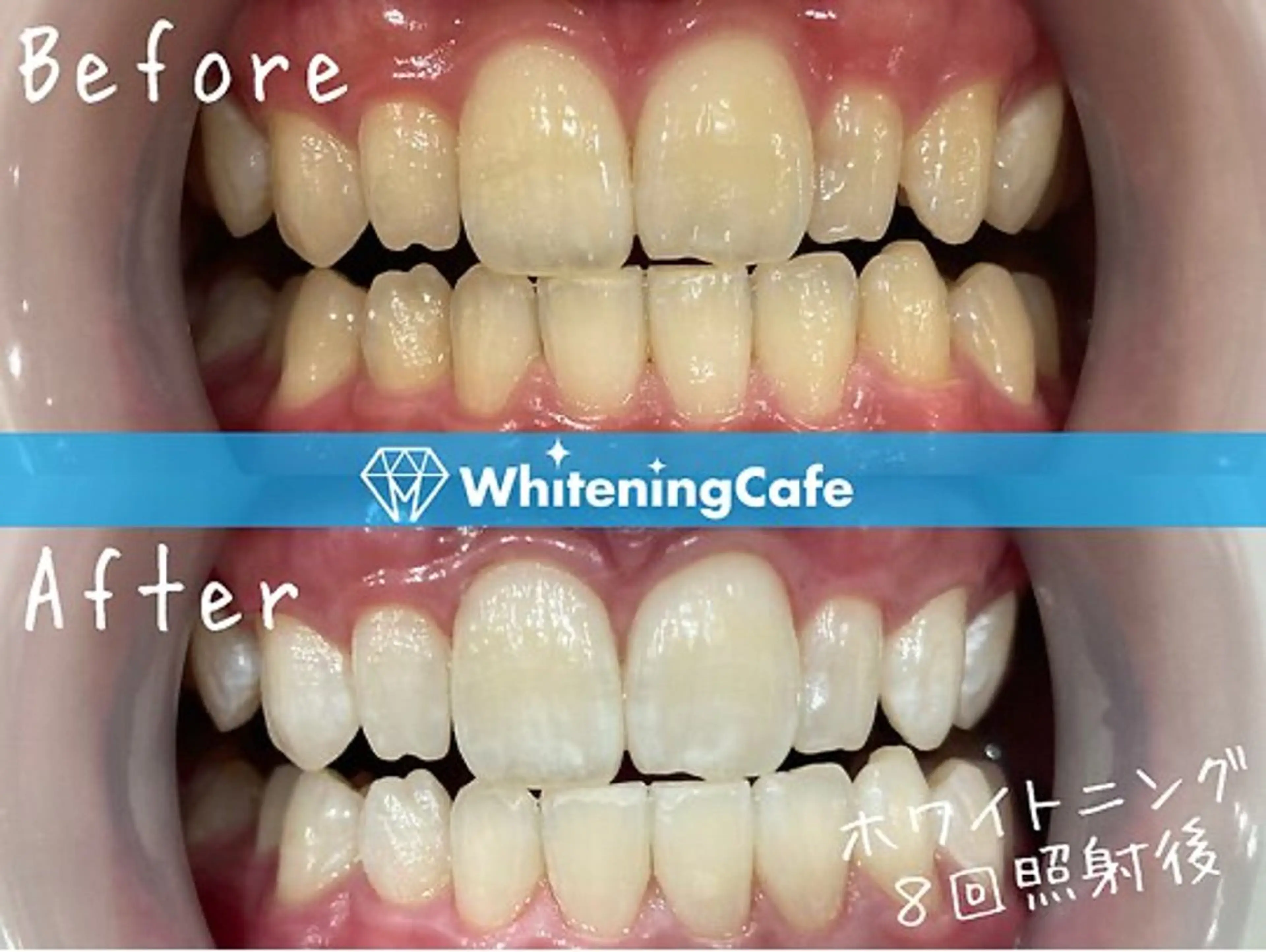 ホワイトニングカフェ 荻窪店のその他イメージ