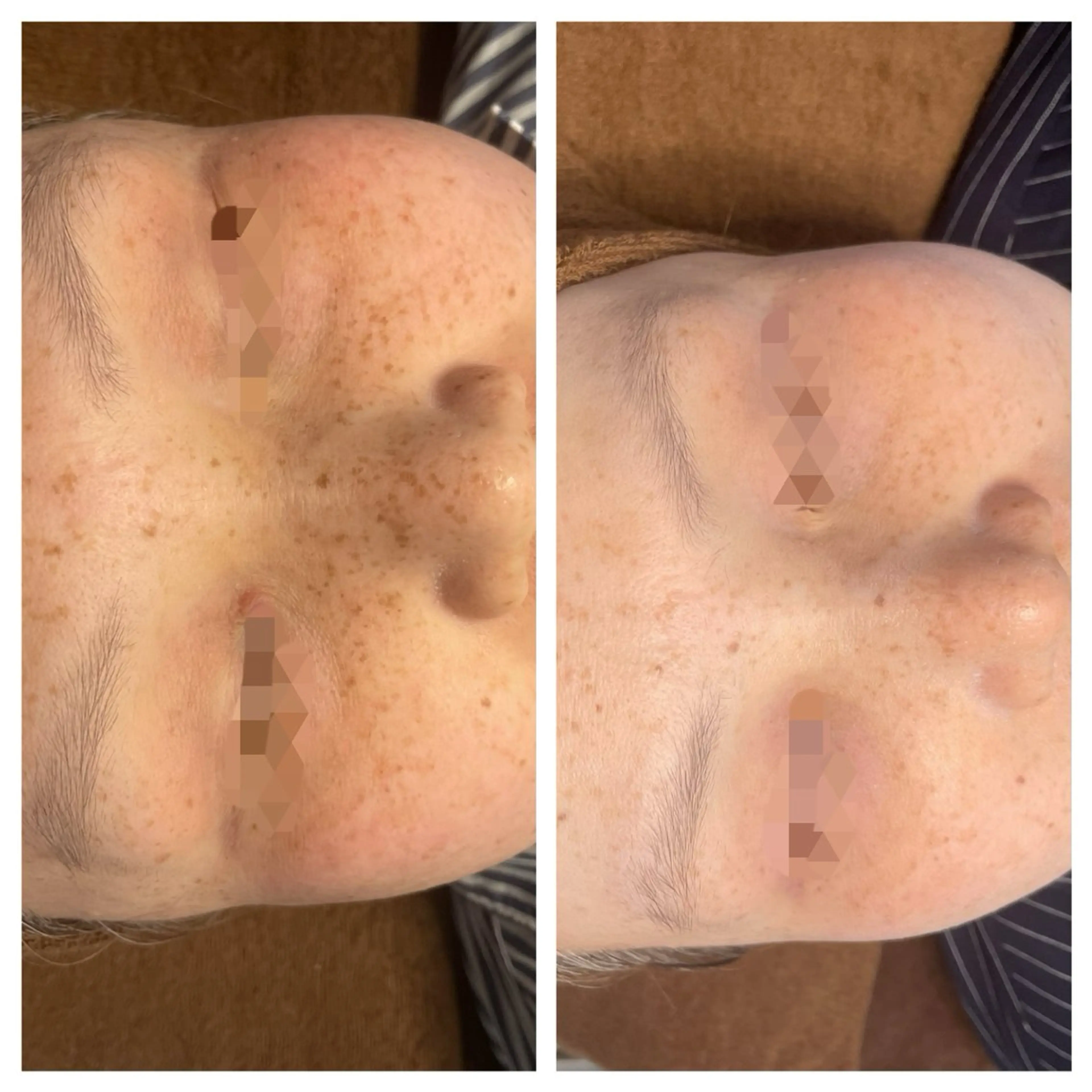 シミケア専門店 モルセラのエステ・リラクイメージ