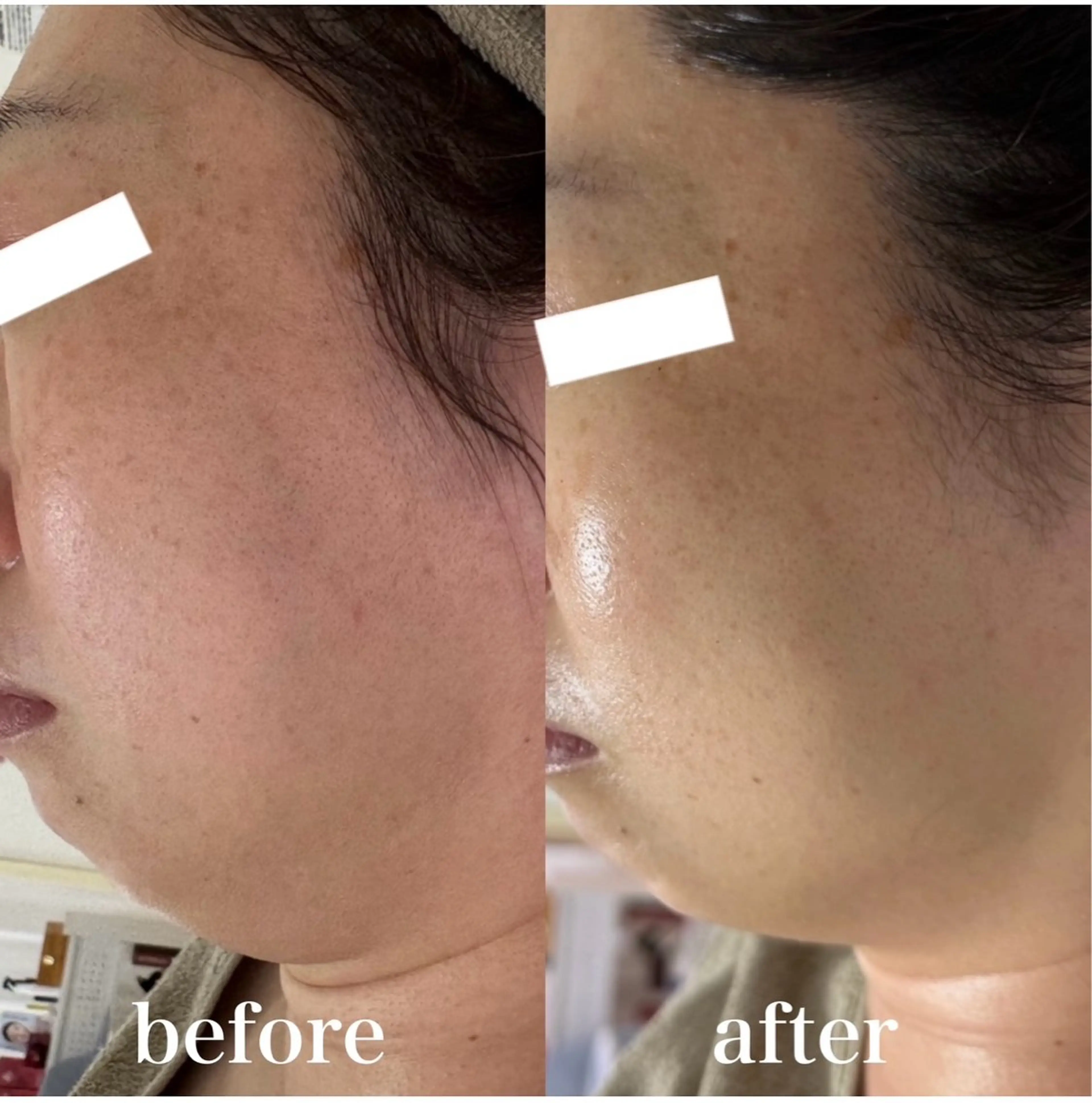 エステ 小顔リフトアップ 美肌改善専門店のエステ・リラクイメージ