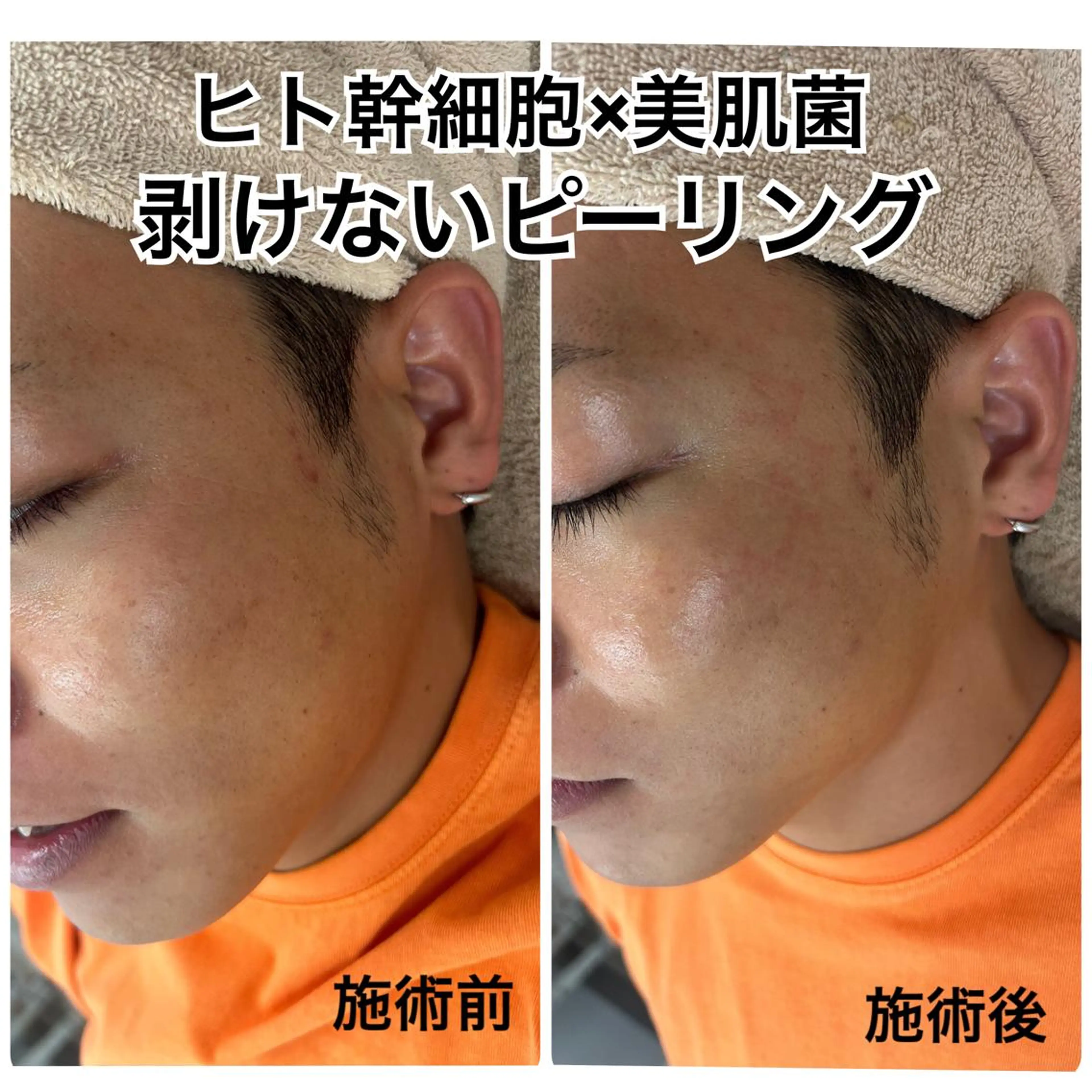 エステ エステサロン Venusのその他イメージ