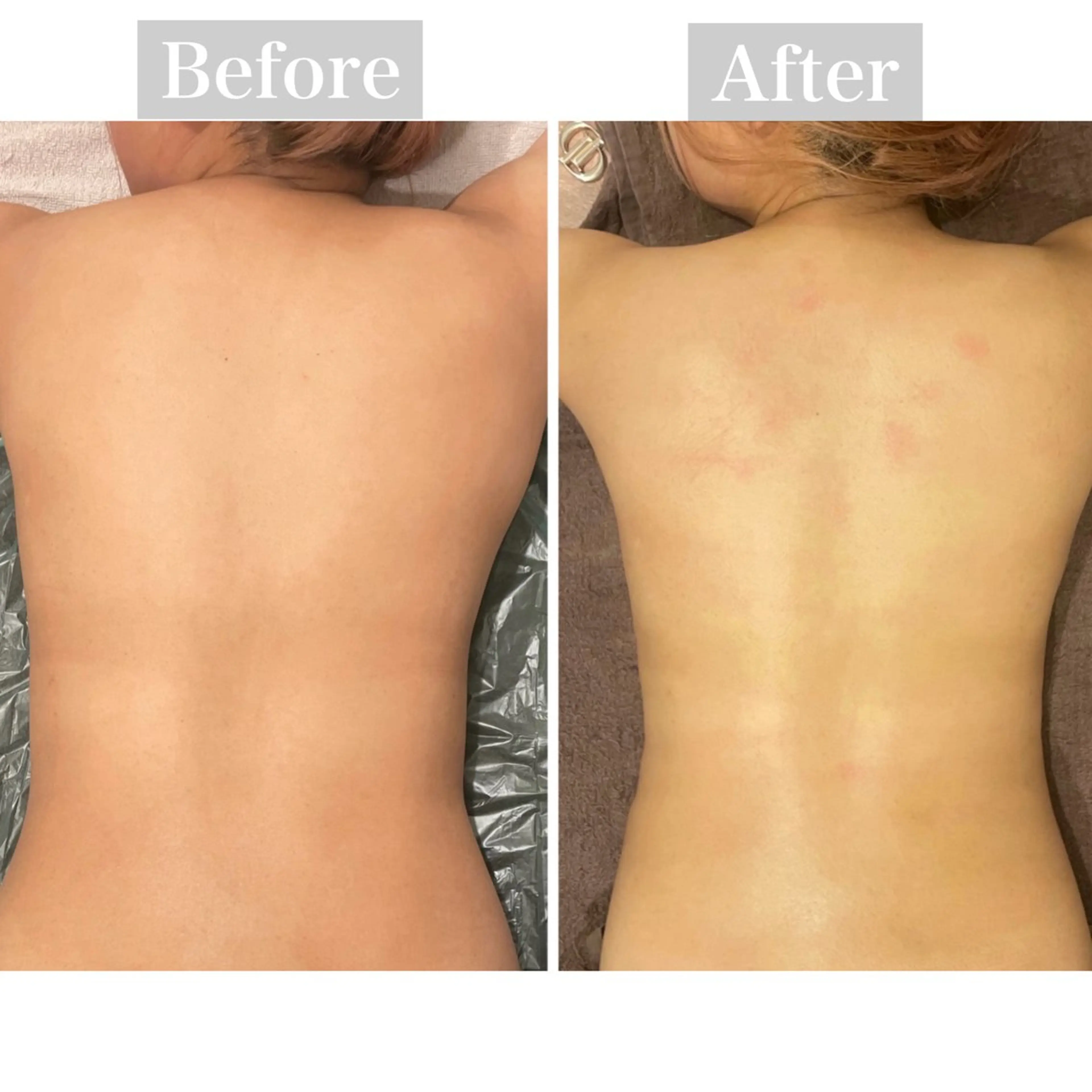 【肩こり・生理痛・足の浮腫み】オイルマッサージ🌿(18~29歳限定)の写真