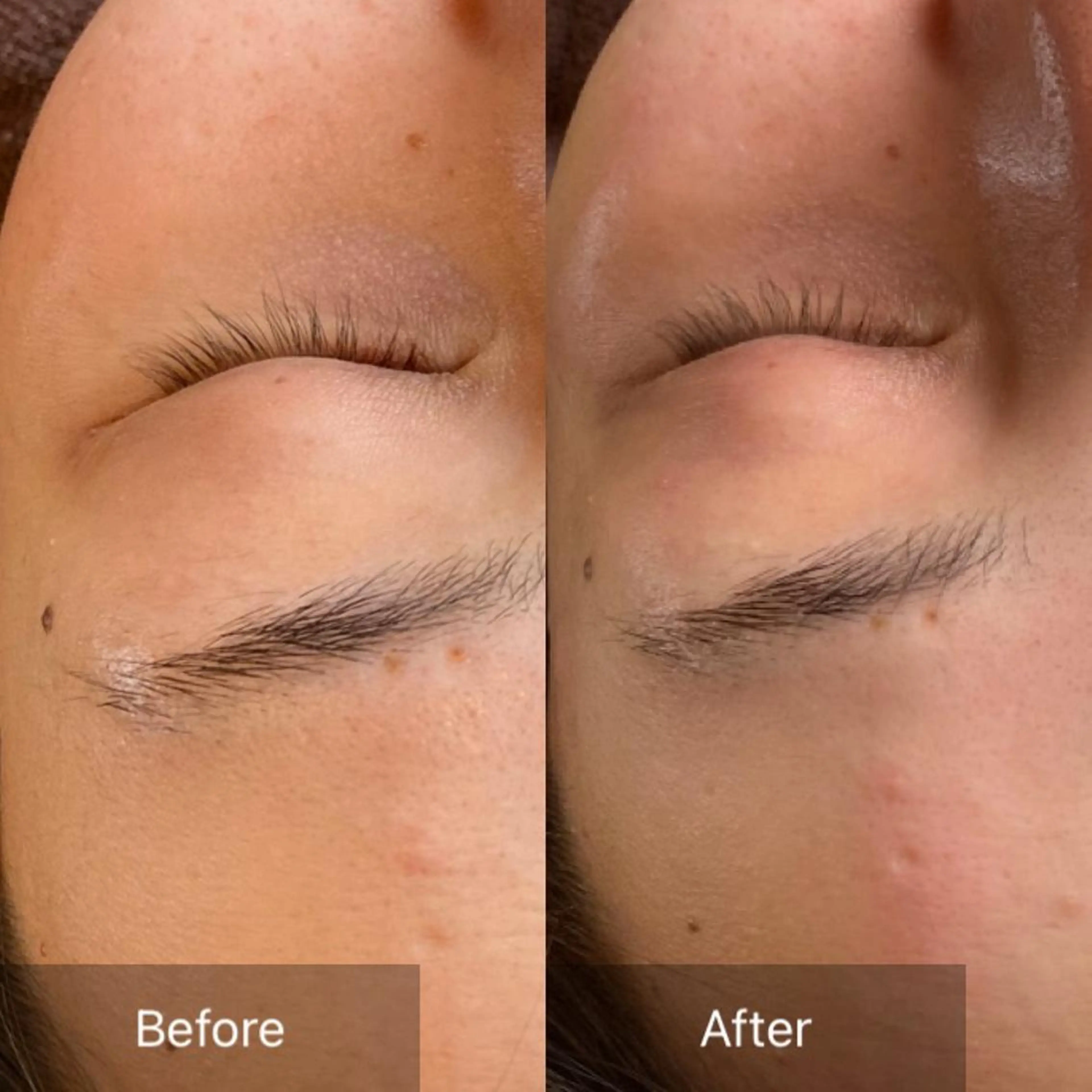 エステ 産毛専門店 Bittoのエステ・リラクイメージ