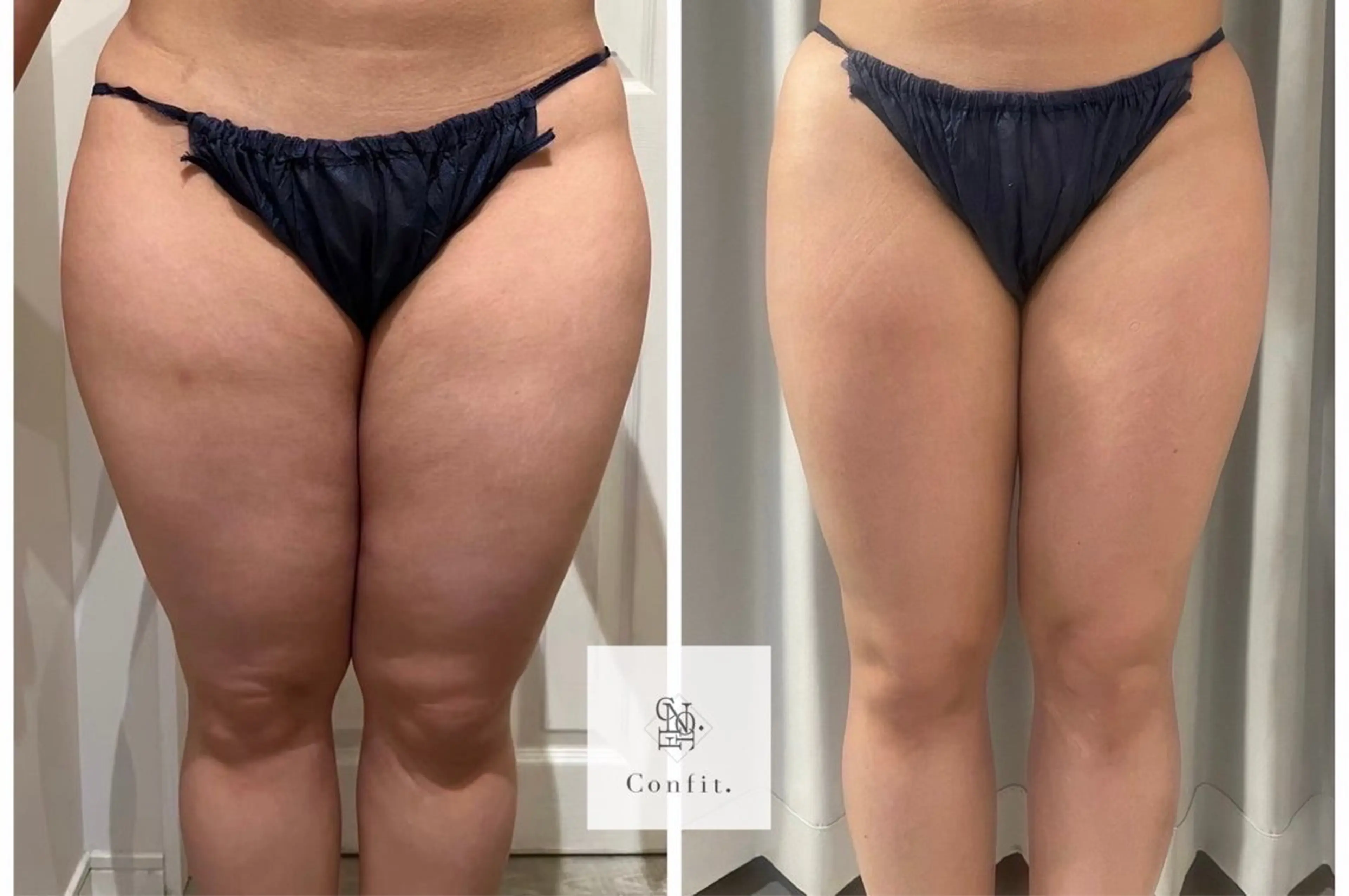 エステ 【小顔痩身専門看護師 サロンSONA】のエステ・リラクイメージ