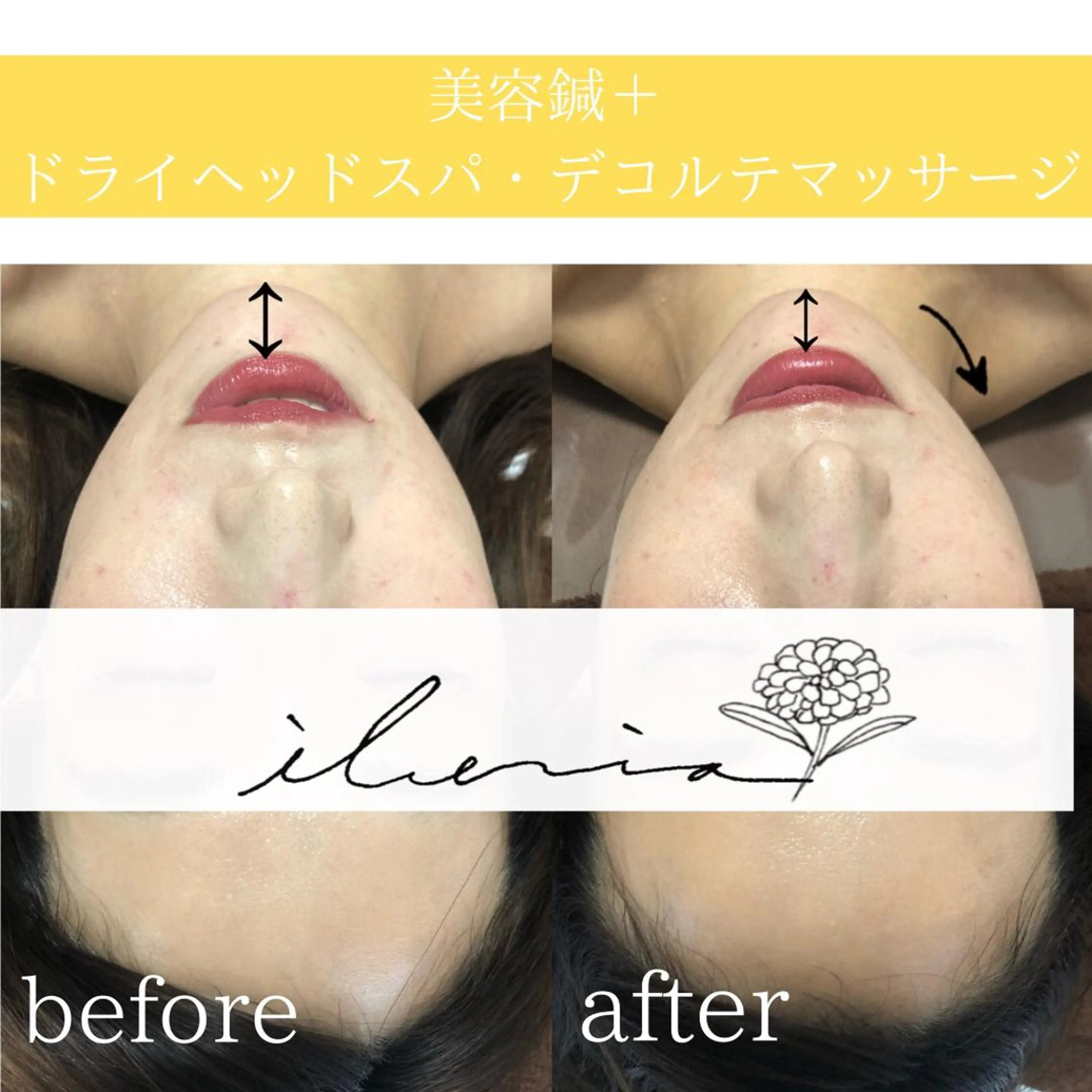 心斎橋痩身ダイエット 韓国.美容鍼.小顔のエステ・リラクイメージ