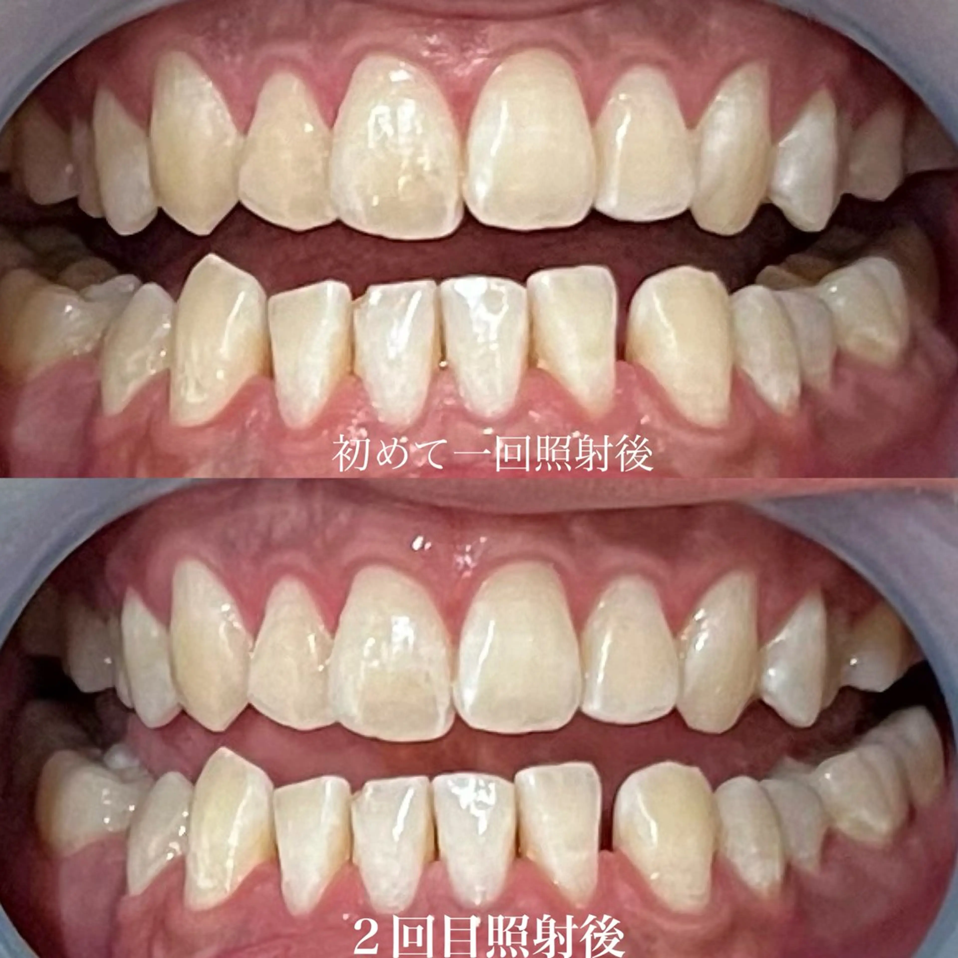 その他 𝐑𝐞𝐯𝐢𝐨 ___堺市西区のマツエク・マツパデザイン