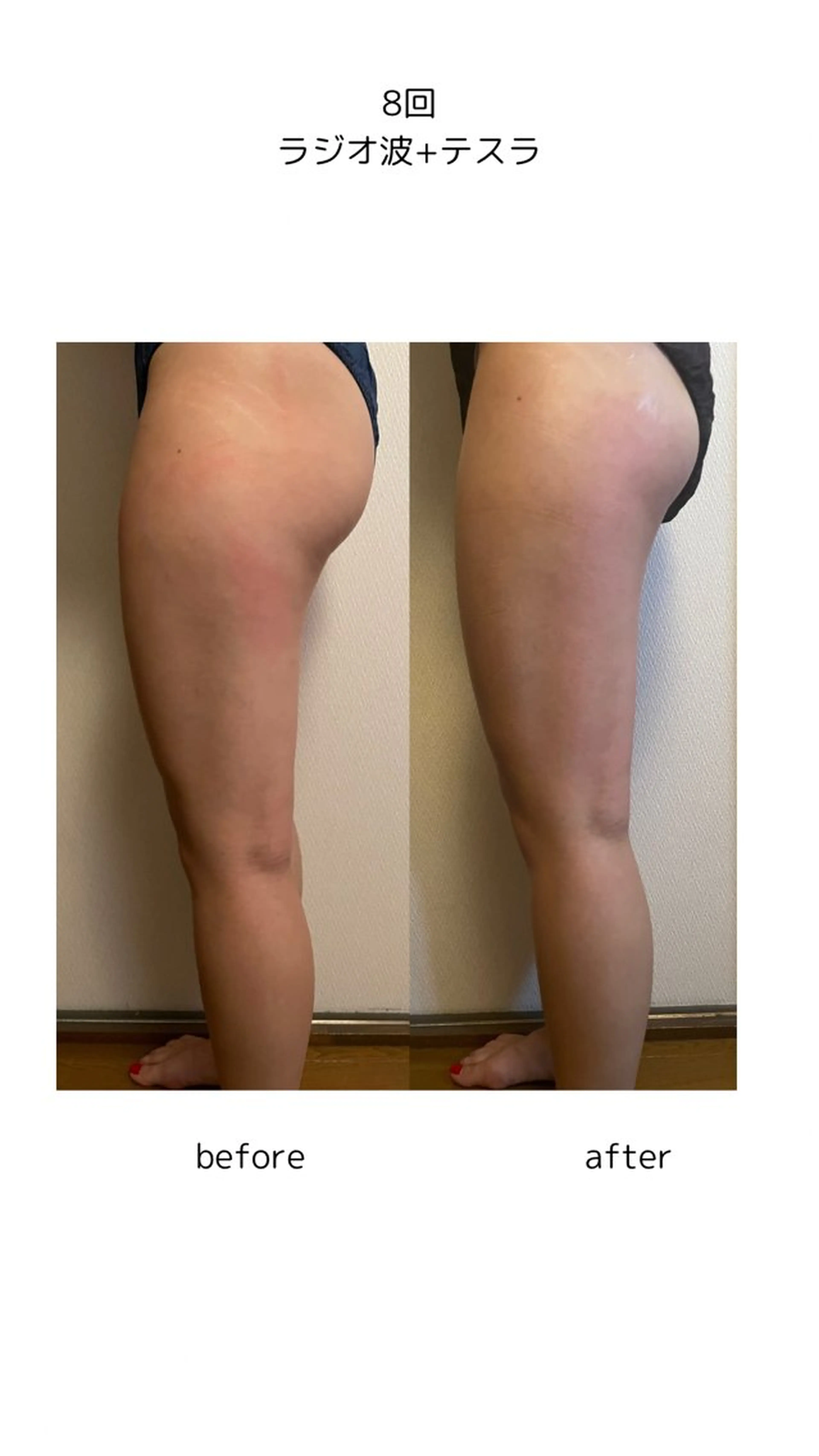 The Best Beauty受付担当のエステ・リラクイメージ