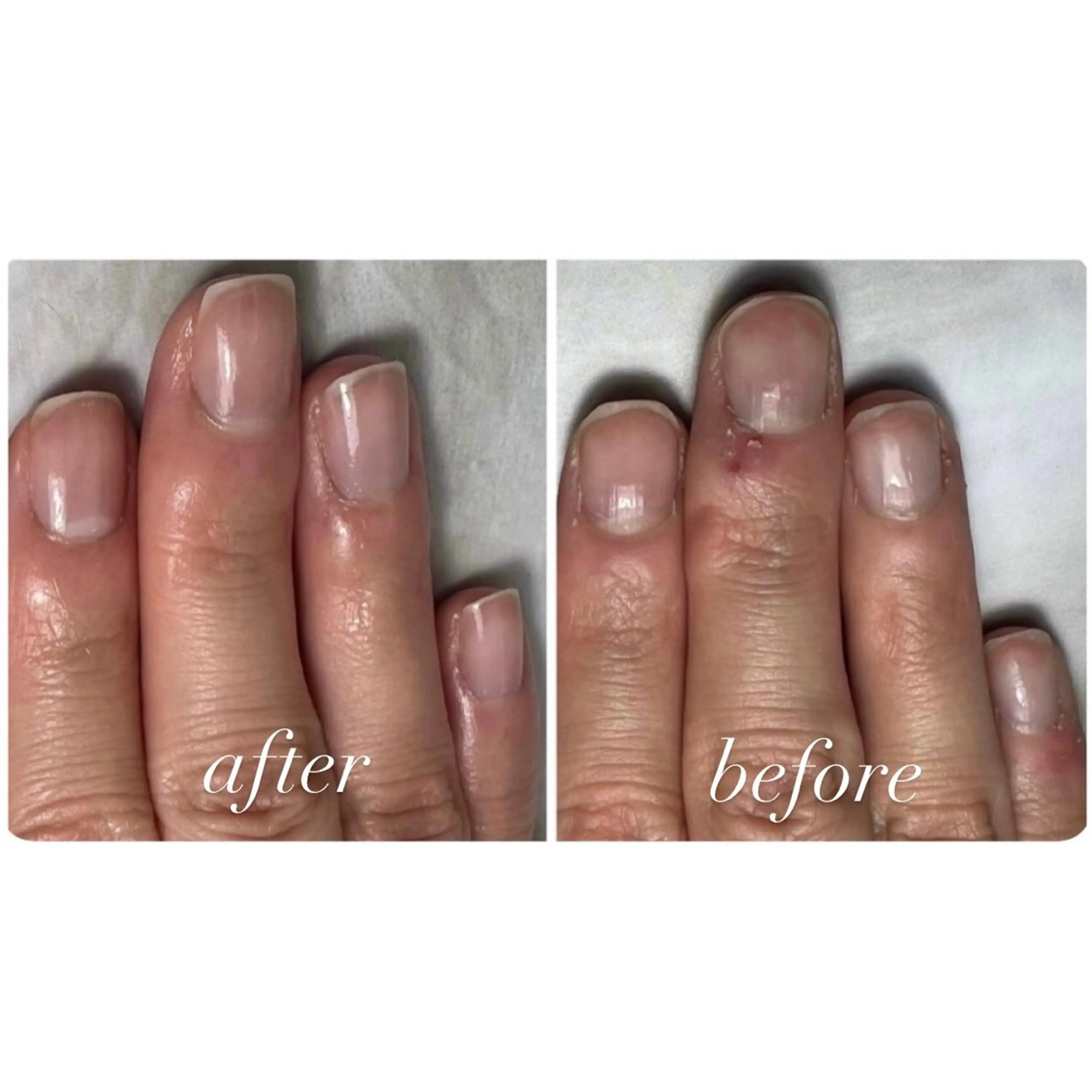 自爪育成(ジェルなし)単品の写真