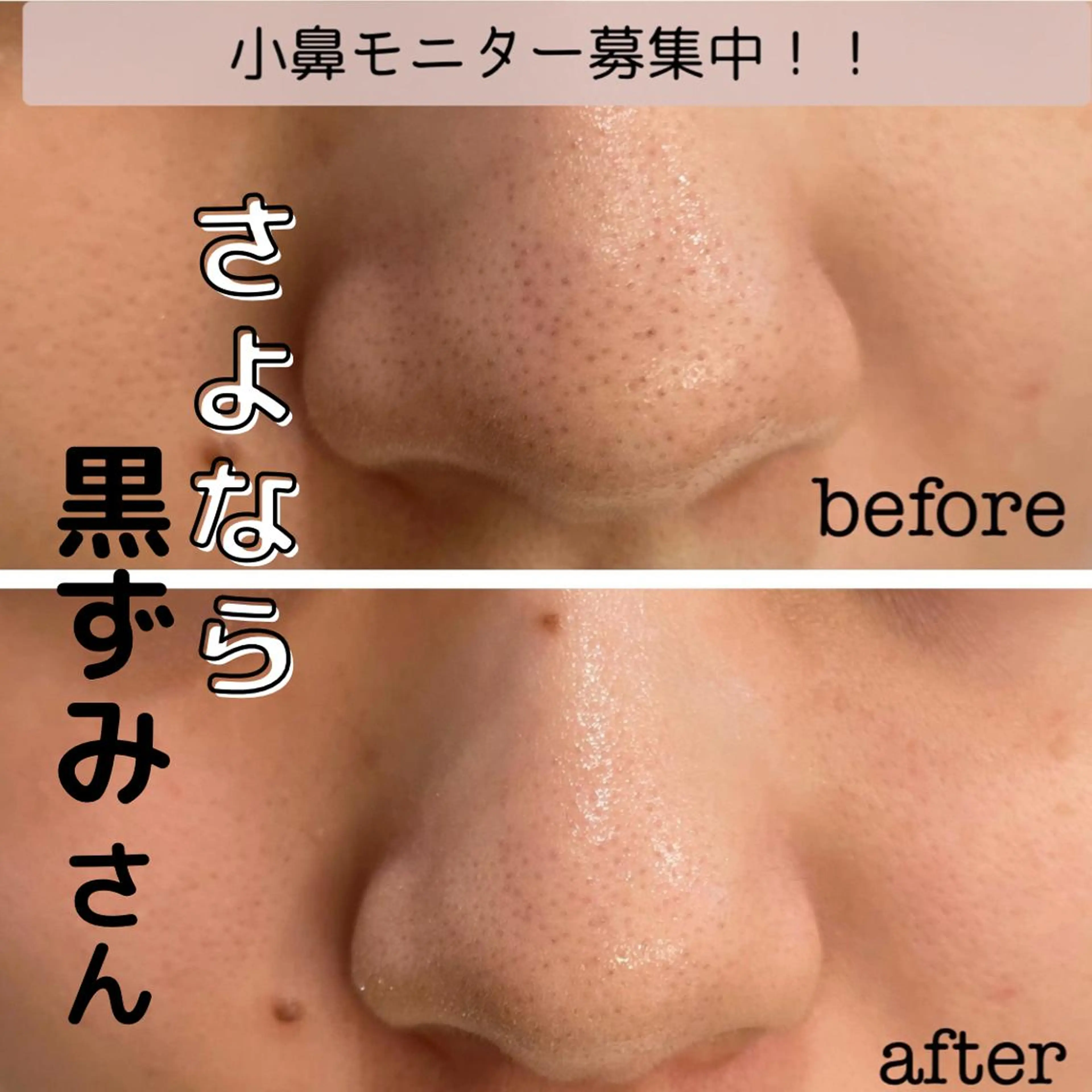 DeI'm   名古屋栄所属・小林 玲菜のエステ・リラクイメージ