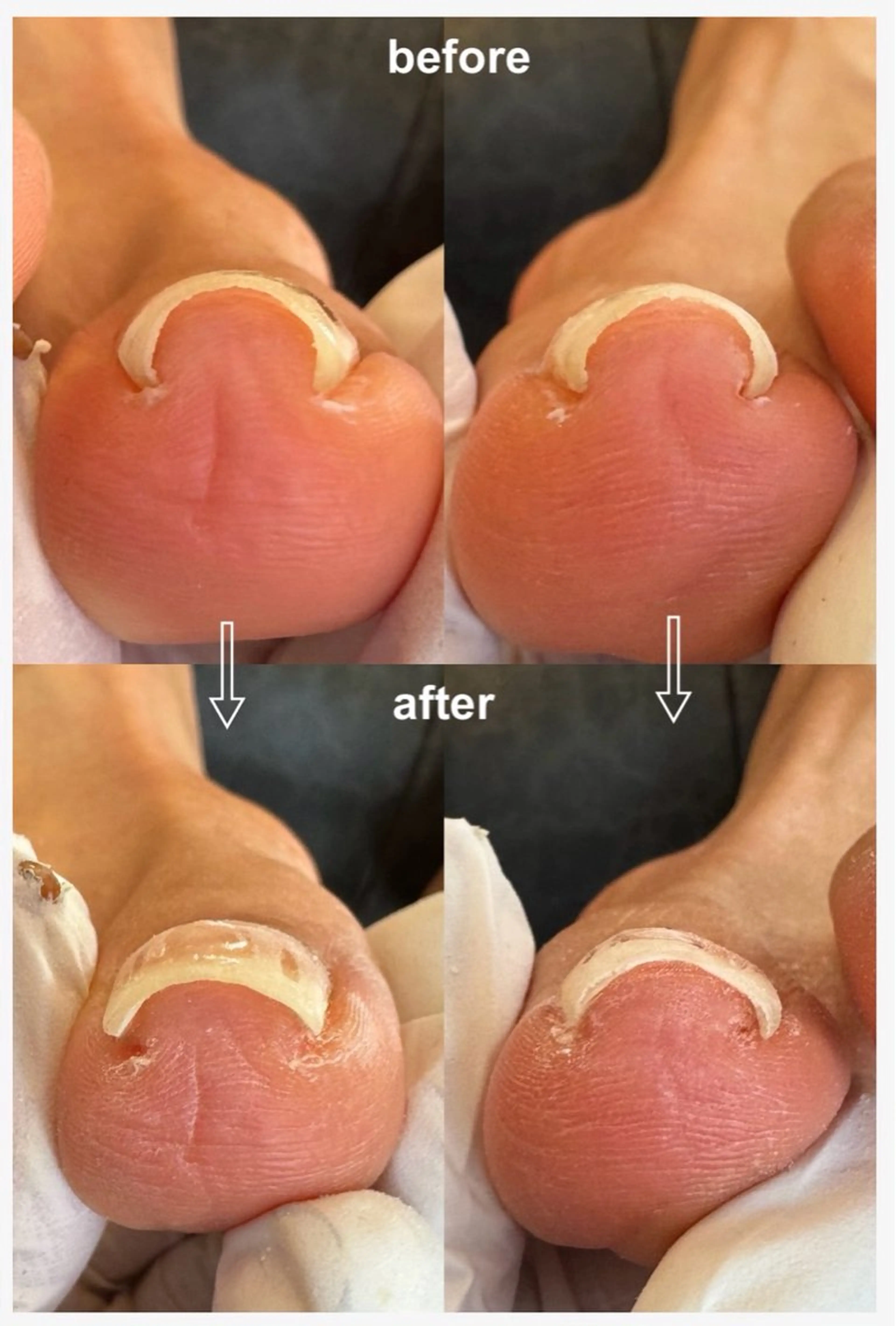 ネイル Sasaki Chiyokoのネイルデザイン