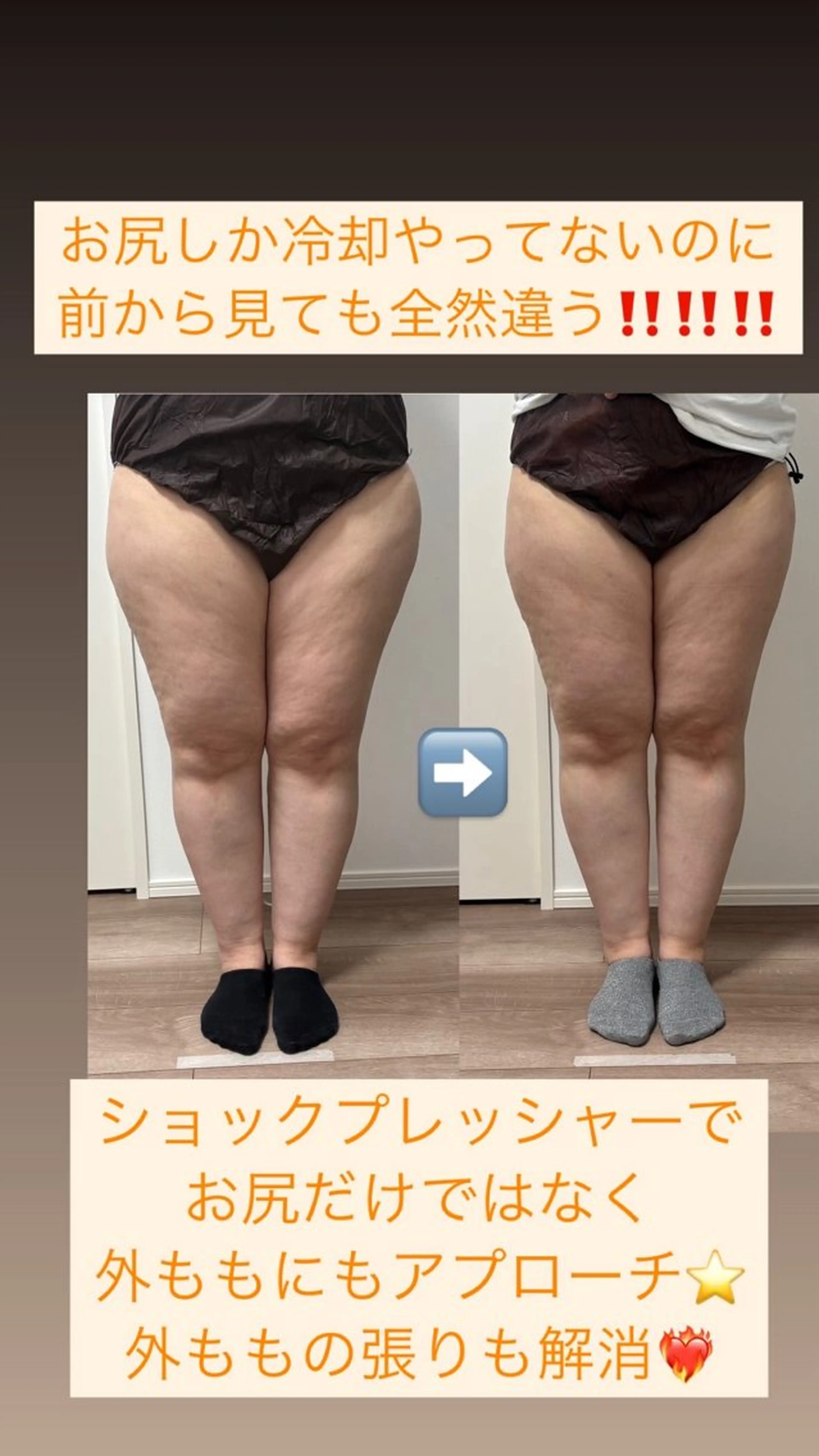 エステ 石巻 冷却痩身 Miiju. 鈴木のその他イメージ