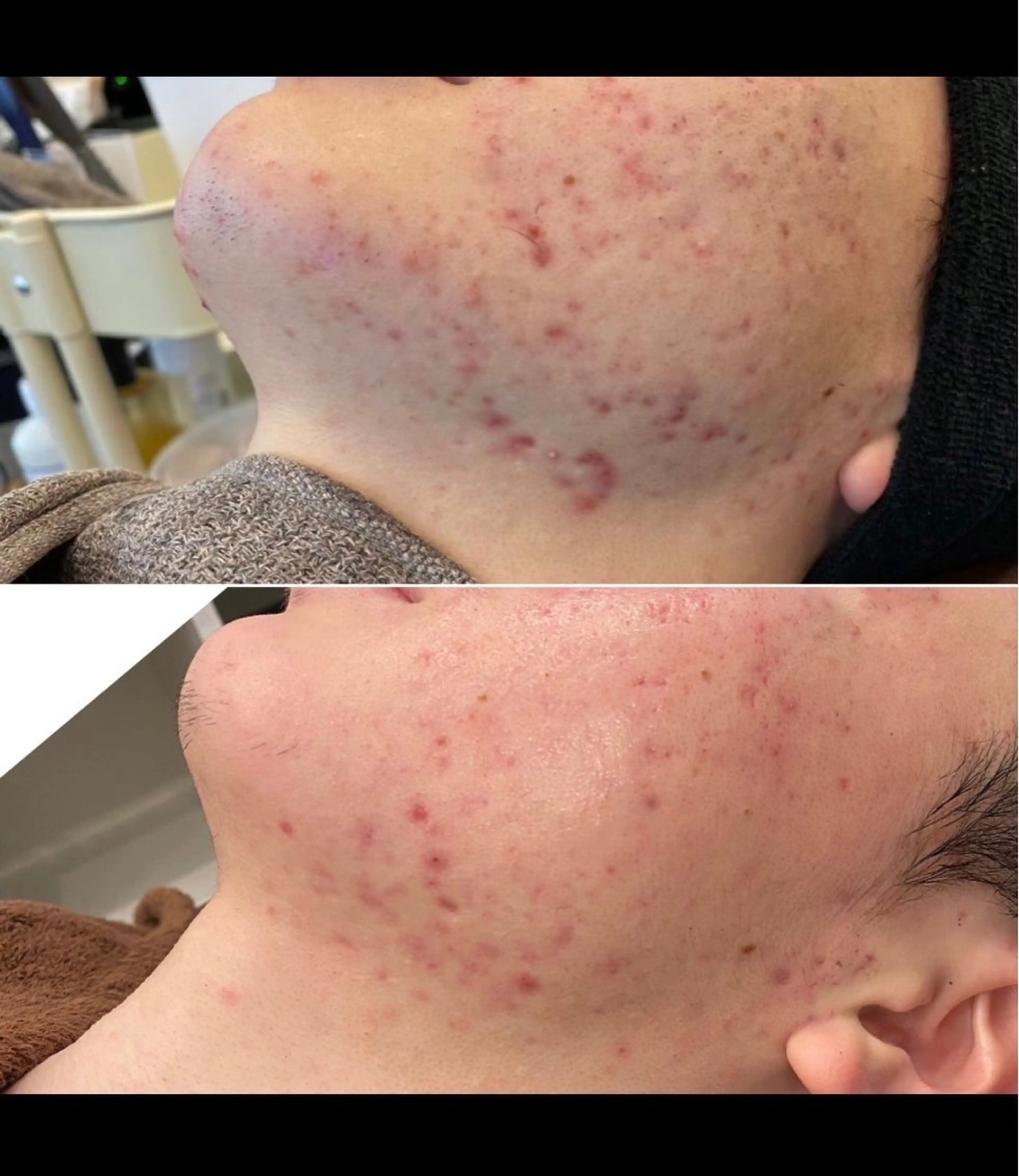 エステ リラク TRUE CARE所属・ハーブピーリング/ 上本町/美肌/幹細胞のエステ・リラクイメージ