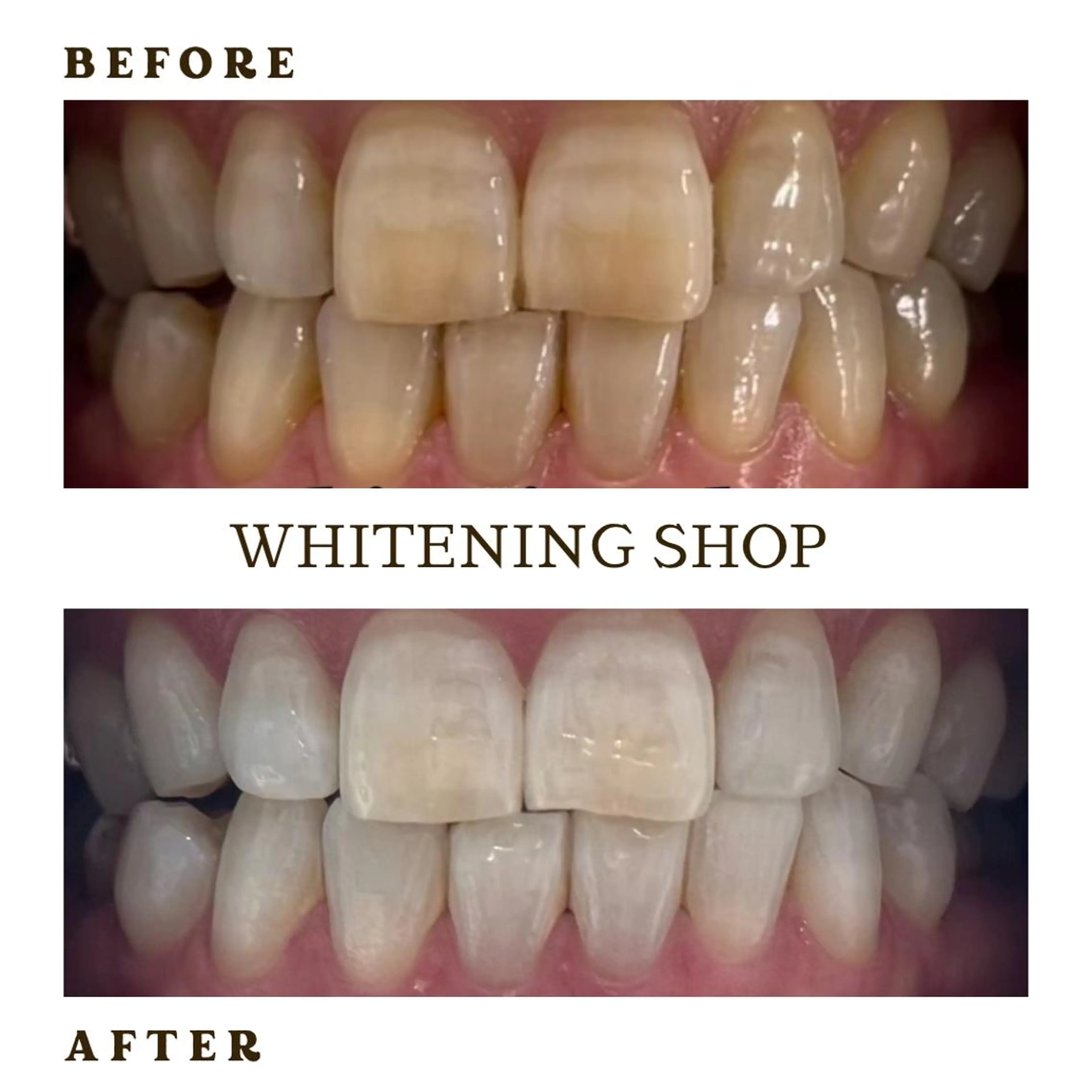 メンズ その他 ホワイトニング ショップ葛西店のその他イメージ