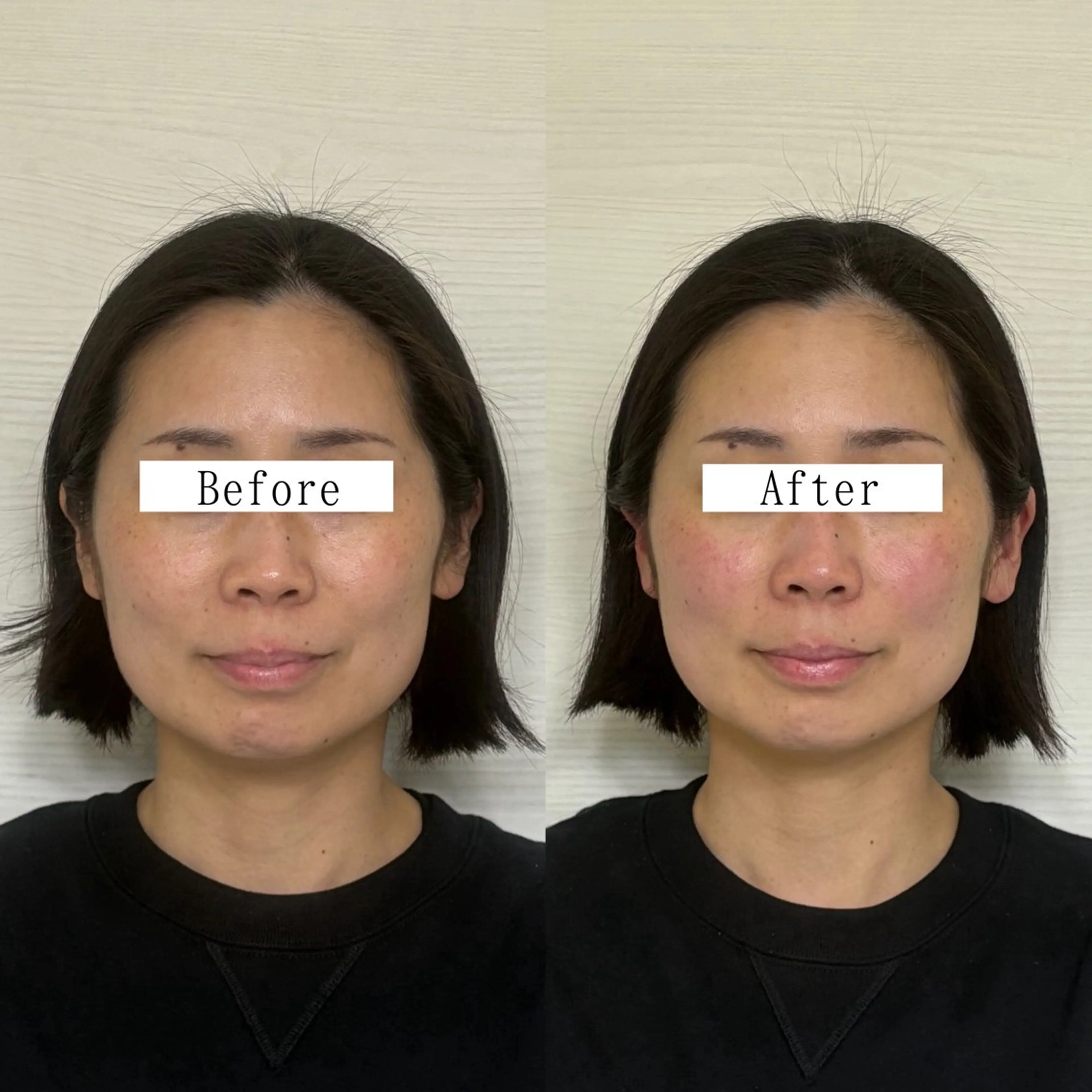 エステ リラク Stellum 小顔矯正&ヘッドスパのエステ・リラクイメージ