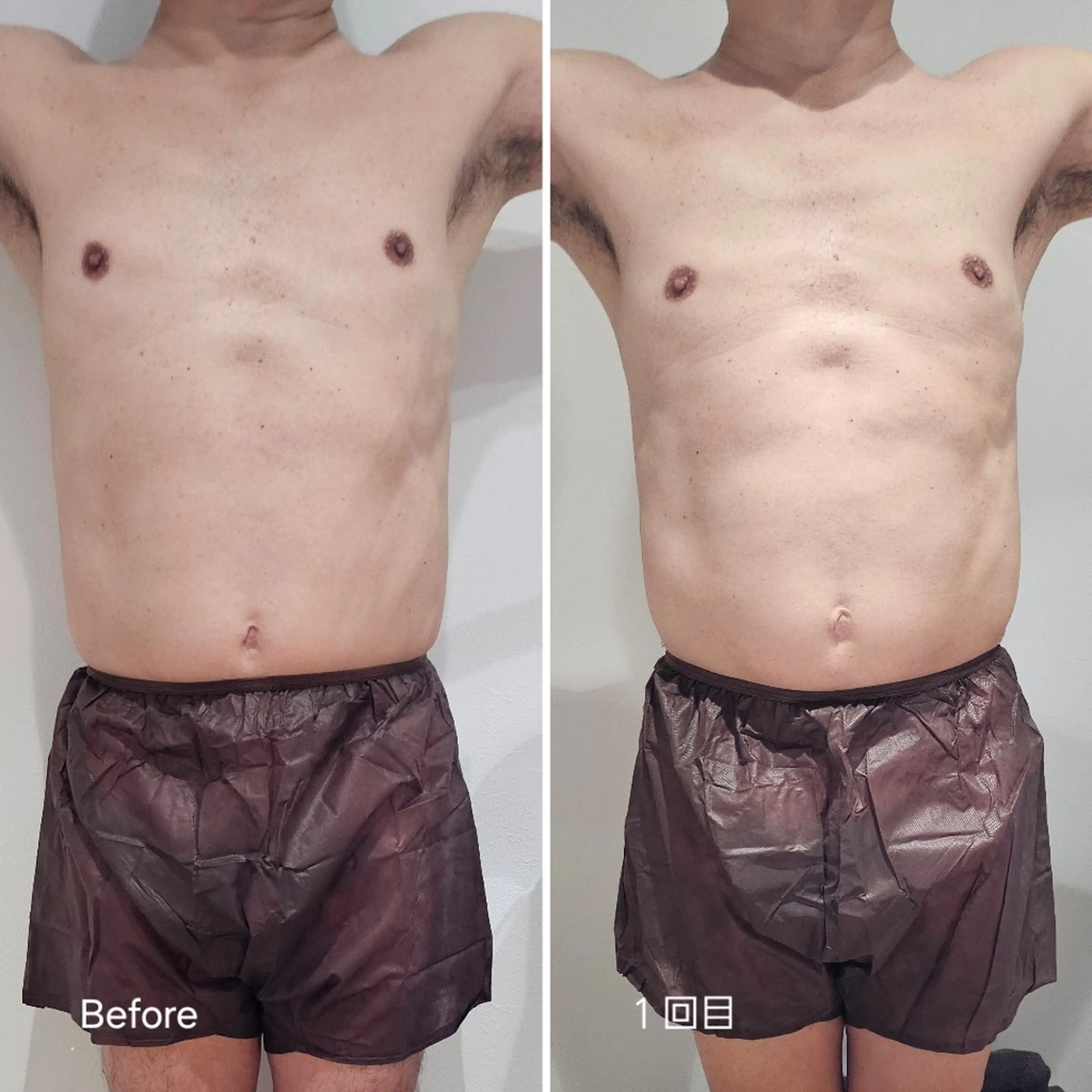 脂肪冷却 & 脱毛 AYUMIのその他イメージ