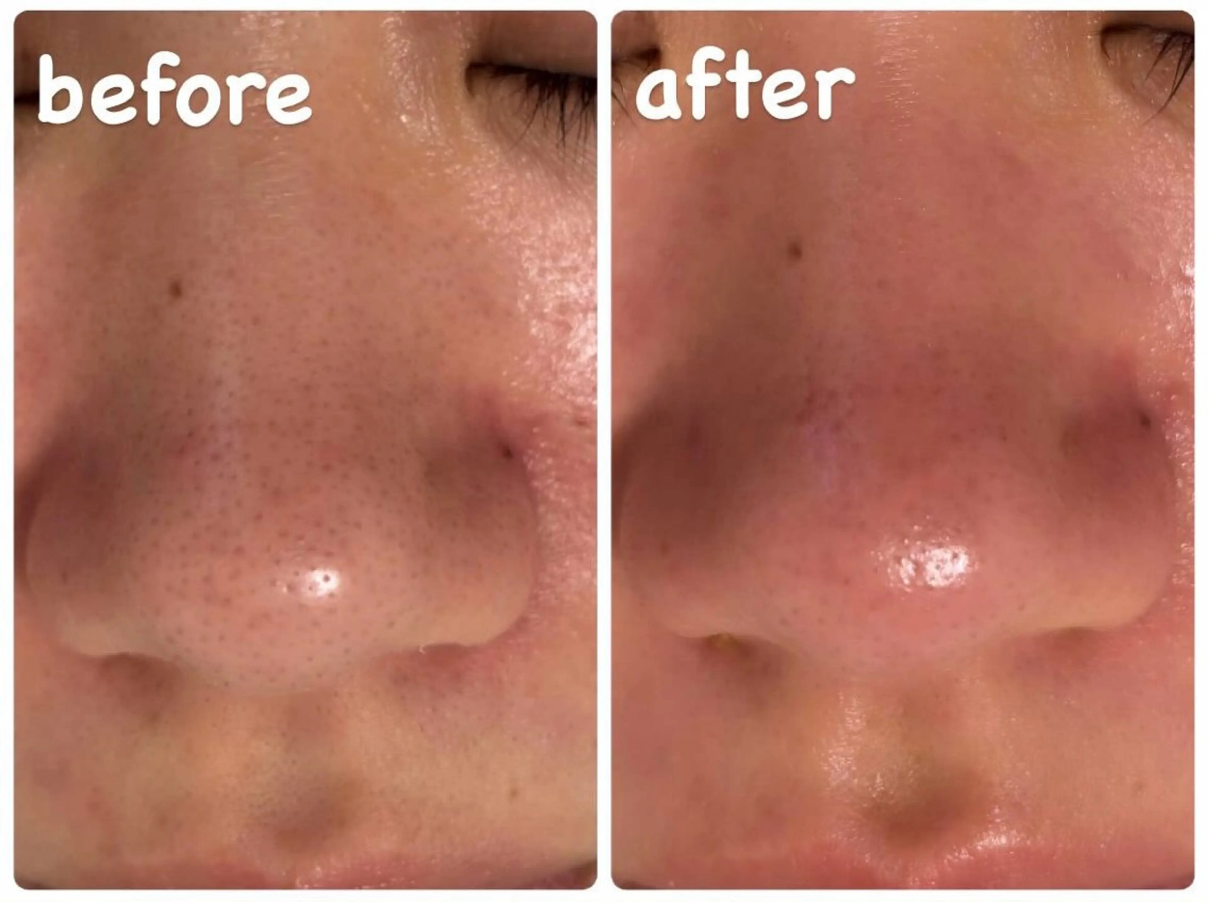 その他 SALON MAREのネイルデザイン