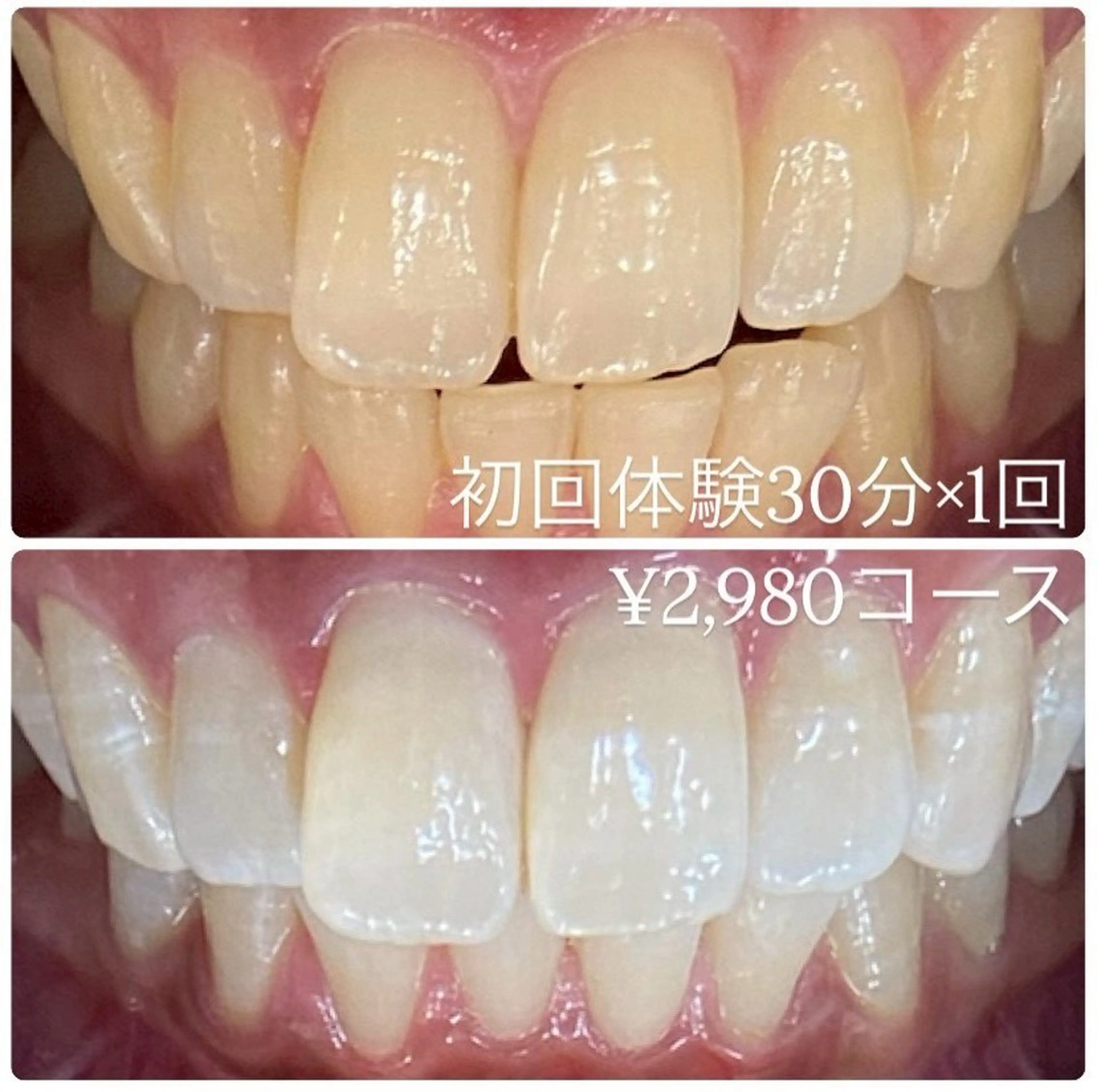 メンズ ホワイトニング ルーム　川崎店のその他イメージ