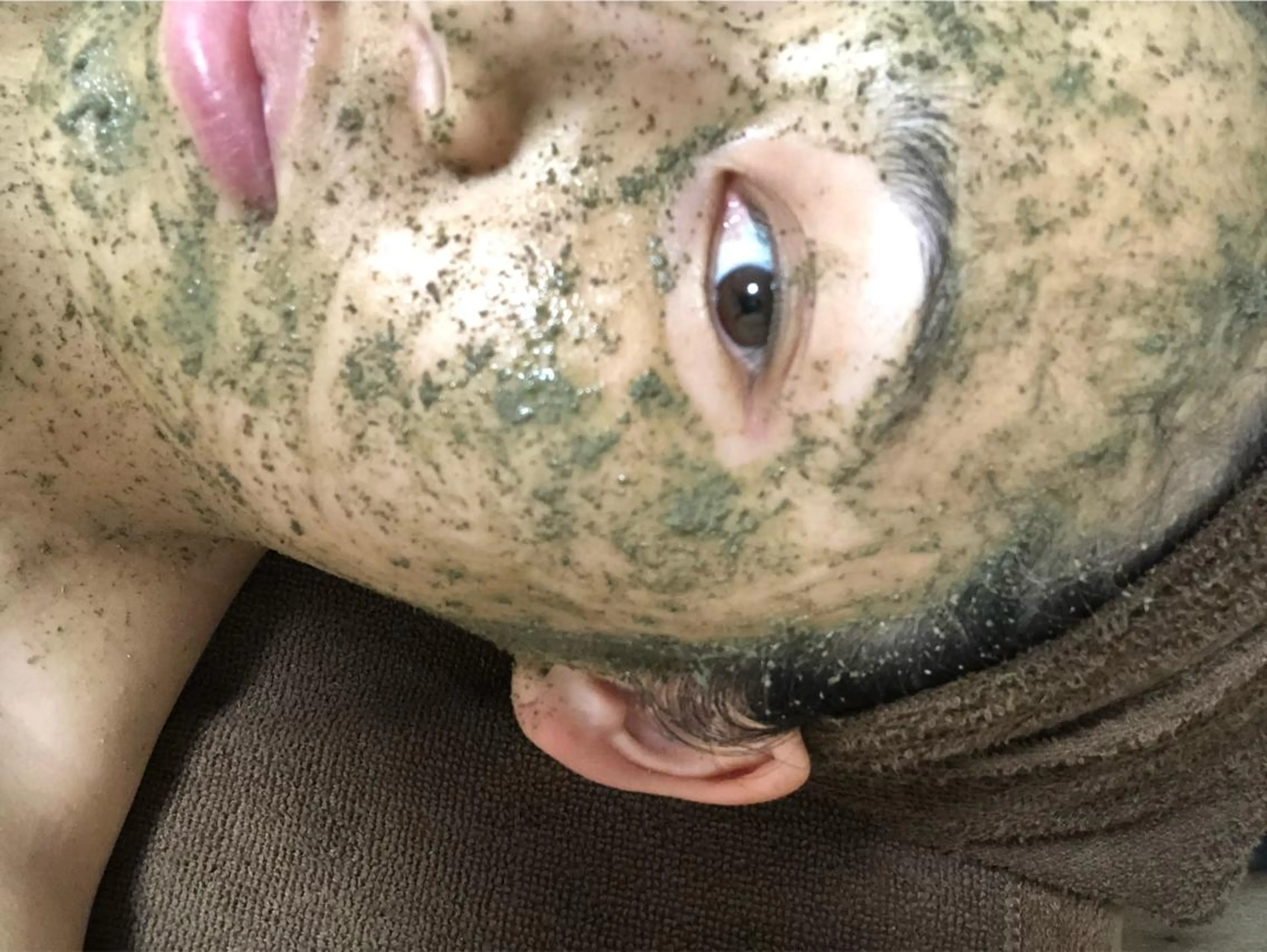 ハーブピーリング🌿スタンダードコースの写真